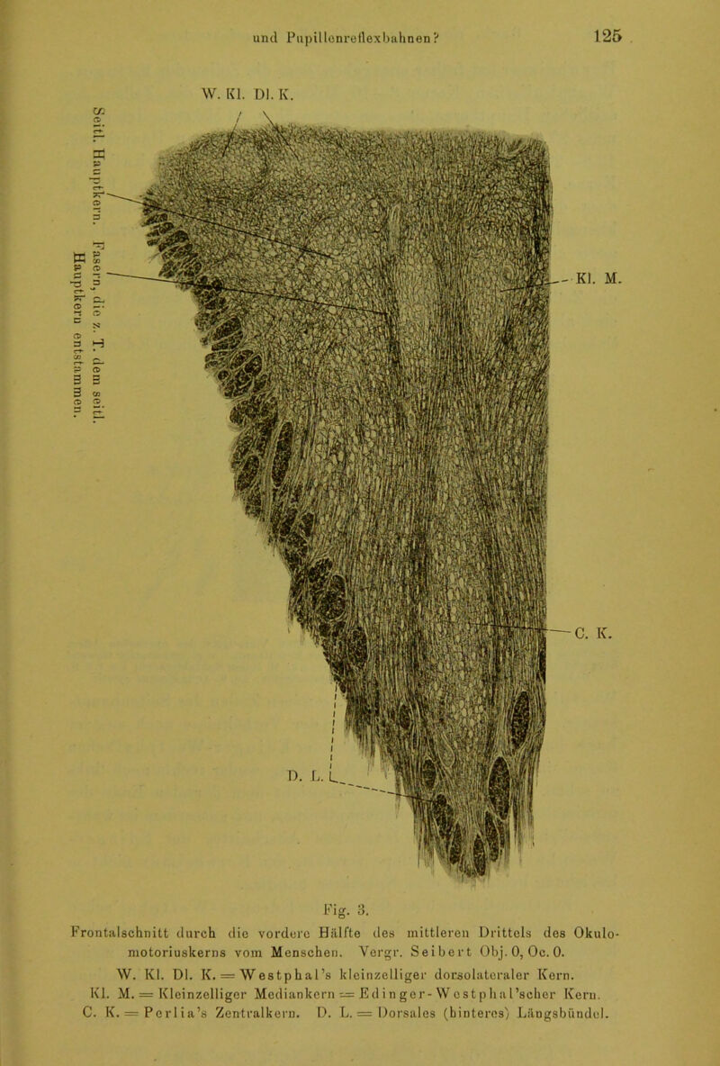 Seitl. Hauptkern. Fasern, die z. T. dem seit]. Hauptkeru entstammen. Kl. M. Fig. 3. Frontalschnitt durch die vordere Hälfte des mittleren Drittels des Okulo- motoriuskerns vom Menschen. Vergr. Seiber t Obj.O, Oc. 0. W. Kl. Dl. K. = Westphal’s kleinzelliger dorsolatcraler Kern. Kl. M. = Kleinzelliger Mediankern = Edinger-Westphal’scher Kern. C. K. = Perlia’s Zentralkern. D. L, = Dorsales (hinteres) Längsbündel.
