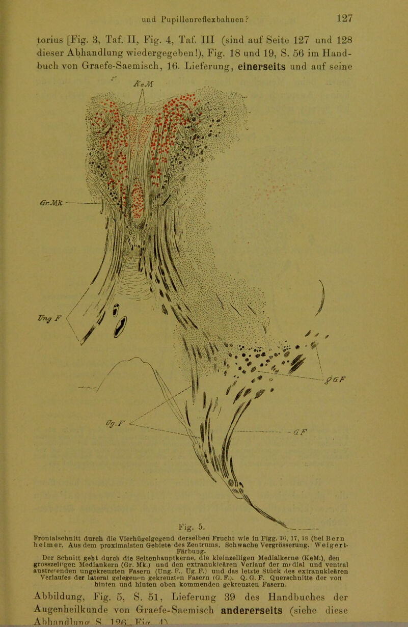 torius [Fig. 3, Taf. II, Fig. 4, Taf. III (sind auf Seite 127 und 128 dieser Abhandlung wiedergegeben!), Fig. 18 und 19, S. 56 im Hand- buch von Graefe-Saemisch, 16. Lieferung, einerseits und auf seine Gr.MK Tfng F Frontalschnitt durch die Vierhügelgegend derselben Frucht wie in Figg. 16, 17, 18 (bei Bern heimer. Aus dem proximalsten Gebiete des Zentrums. Schwache Vergrösseruug. Weigert- Färbung. Der Schnitt geht durch die Seitenhauptkerne, die kleinzelligen Medialkerne (KeM.), den grosszell'gen Mediankern (Gr. Mk.) und den extranukleären Verlauf der nudial und ventral austre'enden ungekreuzten Fasern (Dng. F.. Ug. F.) und das letzte Stück des extranukleären Verlaufes der lateral gelegenen gekreuzten Fasern (G. F.). Q. G. F. Querschnitte der von hinten und hinten oben kommenden gekreuzten Fasern. Abbildung, Fig. 5, S. 51, Lieferung 39 des Handbuches der Augenheilkunde von Graefe-Saemisch andererseits (siehe diese Abhandlung S IQfl.FIrr d\