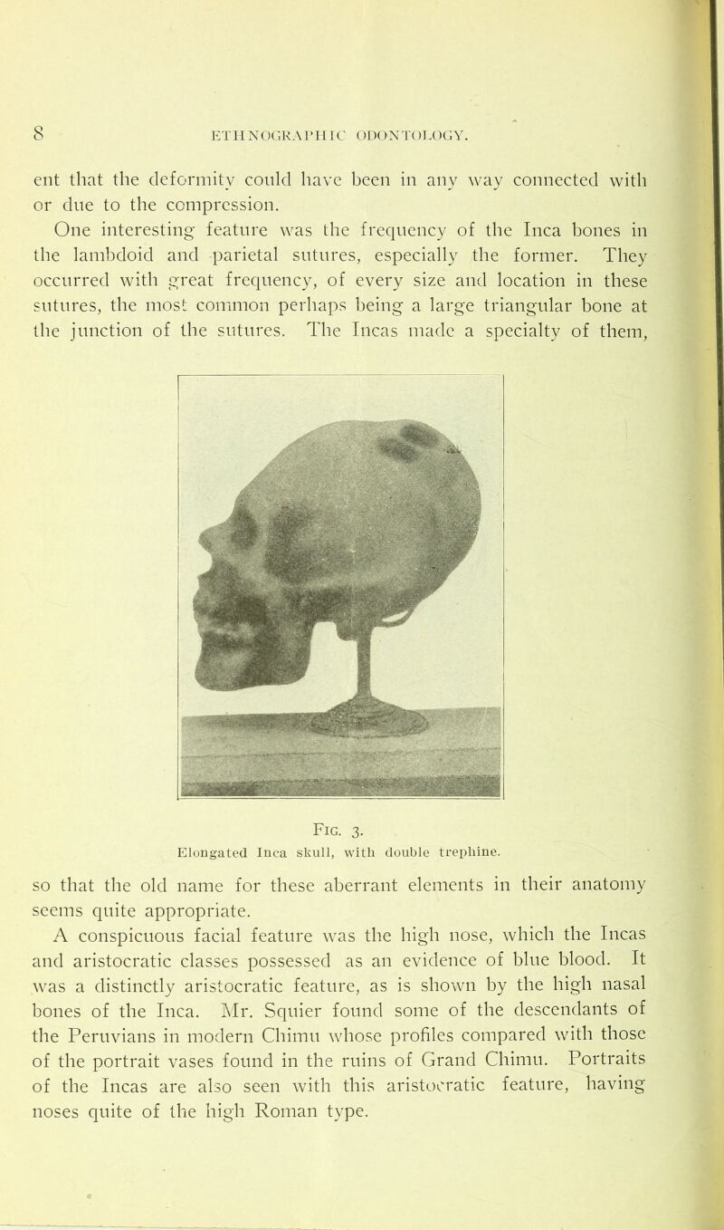 ent that the deformity could have been in any way connected with or due to the compression. One interesting feature was the frequency of the Inca bones in the lambdoid and parietal sutures, especially the former. They occurred with great frequency, of every size and location in these sutures, the most common perhaps being a large triangular bone at the junction of the sutures. The Incas made a specialty of them, Fig. 3. Elongated Inca skull, with double trephine. so that the old name for these aberrant elements in their anatomy seems quite appropriate. A conspicuous facial feature was the high nose, which the Incas and aristocratic classes possessed as an evidence of blue blood. It was a distinctly aristocratic feature, as is shown by the high nasal bones of the Inca. Mr. Squier found some of the descendants of the Peruvians in modern Chimu whose profiles compared with those of the portrait vases found in the ruins of Grand Chimu. Portraits of the Incas are also seen with this aristocratic feature, having noses quite of the high Roman type.