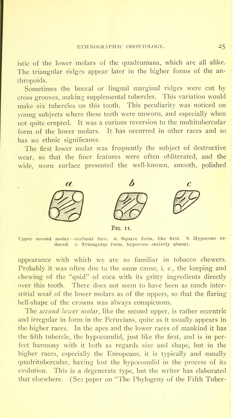 istic of the lower molars of the quadrumana, which are all alike. The triangular ridges appear later in the higher forms of the an- thropoids. Sometimes the buccal or lingual marginal ridges were cut by cross grooves, making supplemental tubercles. This variation would make six tubercles on this tooth. This peculiarity was noticed on young subjects where these teeth were unworn, and especially when not quite erupted. It was a curious reversion to the multitubercular form of the lower molars. It has occurred in other races and so has no ethnic signiiicance. The first lower molar was frequently the subject of destructive wear, so that the finer features were often obliterated, and the wide, worn surface presented the well-known, smooth, polished €L b C Fig. II. Upper second molar—occlusal face. a. Square form, like first, h. Hypocone re- duced. c. Triangul4,r form, hypocone entirely absent. appearance with which we are so familiar in tobacco chewers. Probably it was often due to the same cause, i. e., the keeping and chewing of the “quid’^ of coca with its gritty ingredients directly over this tooth. There does not seem to have been as much inter- stitial wear of the lower molars as of the uppers, so that the flaring liell-shape of the crowns was always conspicuous. The second lower molar, like the second upper, is rather eccentric and irregular in form in the Peruvians, quite as it usually appears in the higher races. In the apes and the lower races of mankind it has the fifth tubercle, the hypoconulid, just like the first, and is in per- fect harmony with it both as regards size and shape, but in the higher races, especially the Europeans, it is typically and usually quadritubercular, having lost the hypoconulid in the process of its evolution. This is a degenerate type, but the writer has elaborated that elsewhere. (See paper on “The Phylogeny of the Fifth Tuber-