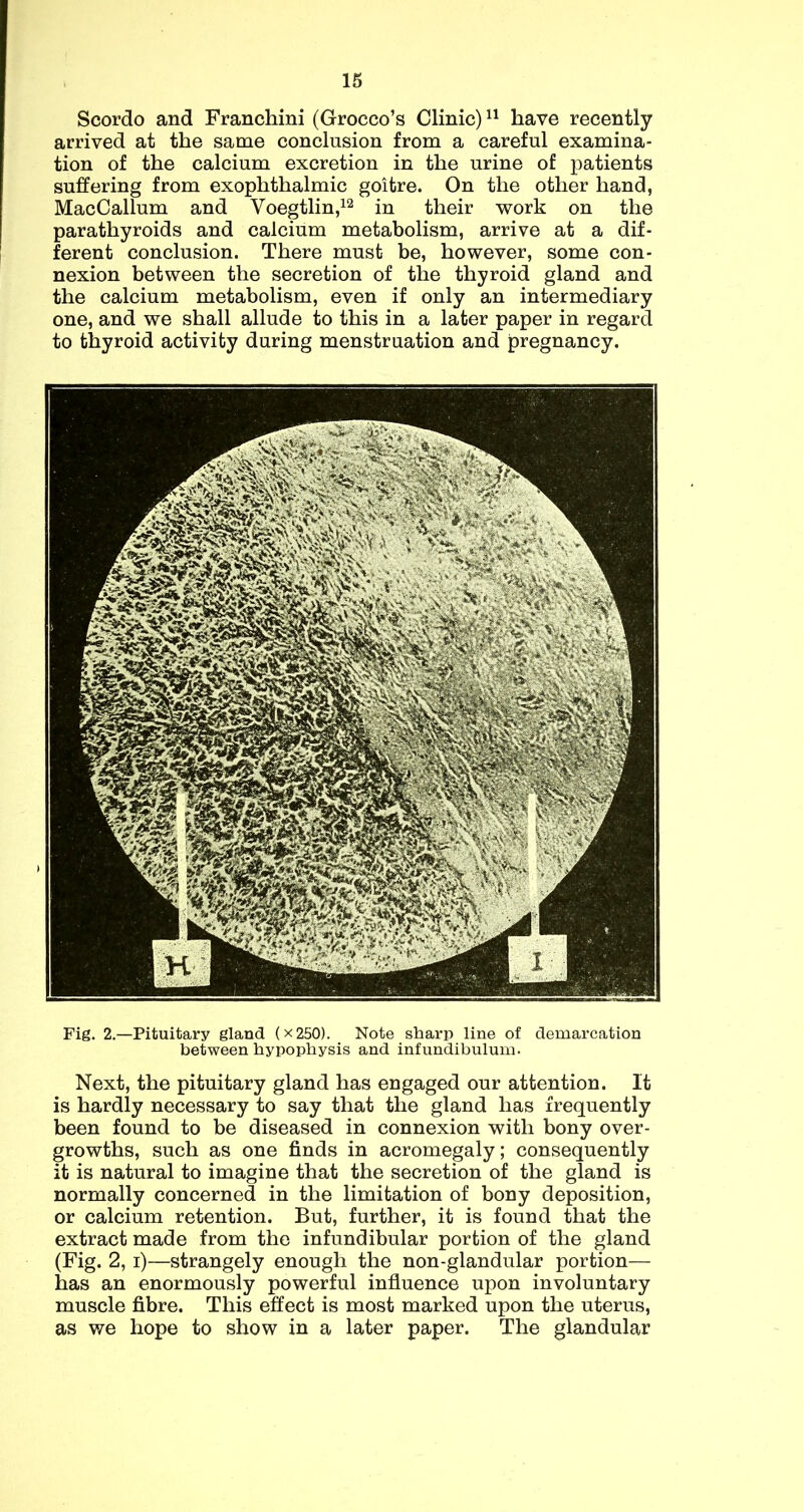 Scordo and Franchini (Grocco’s Clinic) have recently arrived at the same conclusion from a careful examina- tion of the calcium excretion in the urine of patients suffering from exophthalmic goitre. On the other hand, MacCallum and Voegtlin,^^ in their work on the parathyroids and calcium metabolism, arrive at a dif- ferent conclusion. There must be, however, some con- nexion between the secretion of the thyroid gland and the calcium metabolism, even if only an intermediary one, and we shall allude to this in a later paper in regard to thyroid activity during menstruation and pregnancy. Fig. 2.—Pituitary gland (x250). Note sharp line of demarcation between hypophysis and infundibulum. Next, the pituitary gland has engaged our attention. It is hardly necessary to say that the gland has frequently been found to be diseased in connexion with bony over- growths, such as one finds in acromegaly; consequently it is natural to imagine that the secretion of the gland is normally concerned in the limitation of bony deposition, or calcium retention. But, further, it is found that the extract made from the infundibular portion of the gland (Fig. 2, i)—strangely enough the non-glandular portion— has an enormously powerful influence upon involuntary muscle fibre. This effect is most marked upon the uterus, as we hope to show in a later paper. The glandular