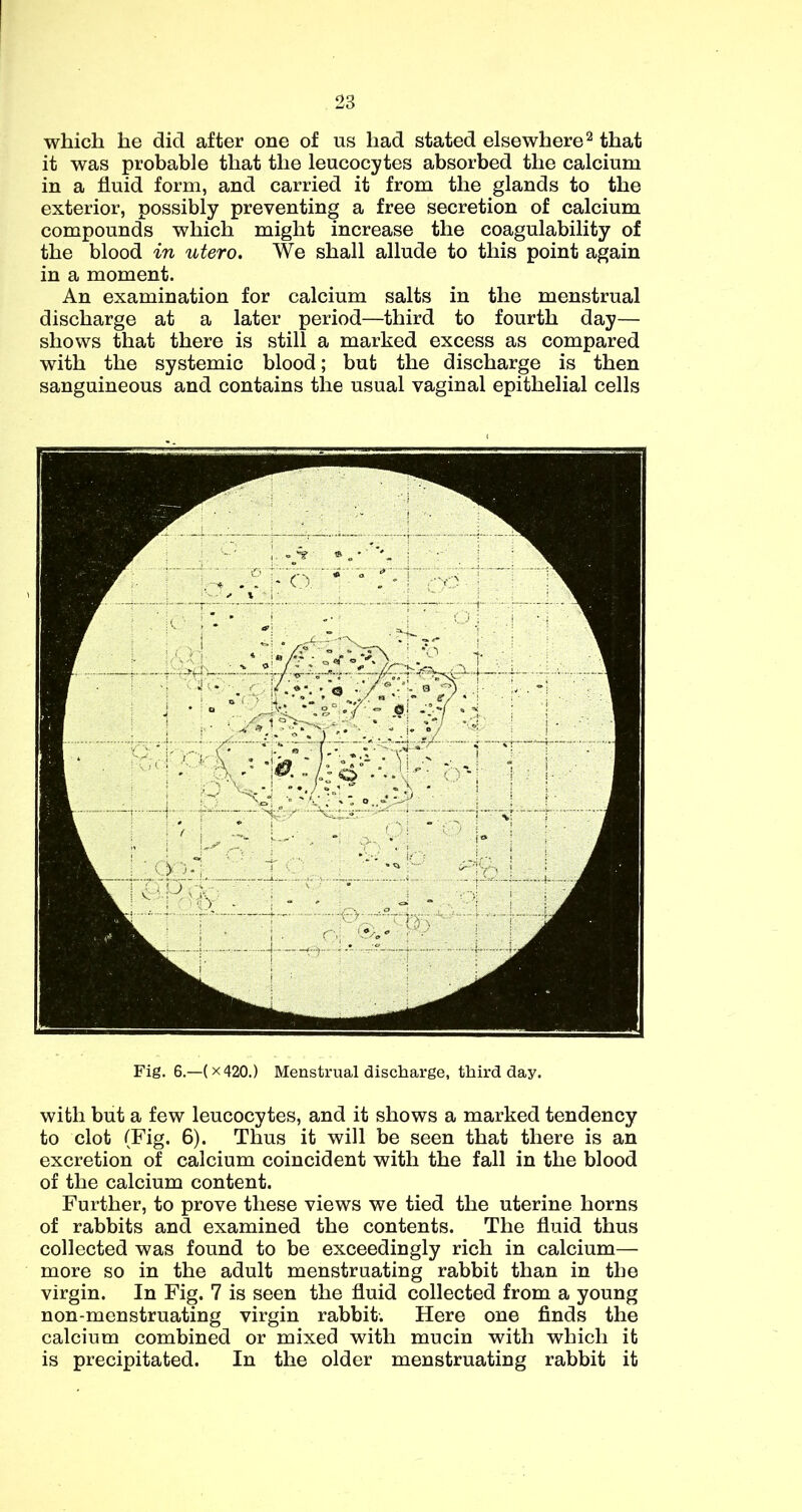 which he did after one of us had stated elsewhere^ that it was probable that the leucocytes absorbed the calcium in a fluid form, and carried it from the glands to the exterior, possibly preventing a free secretion of calcium compounds which might increase the coagulability of the blood in utero. We shall allude to this point again in a moment. An examination for calcium salts in the menstrual discharge at a later period—third to fourth day— shows that there is still a marked excess as compared with the systemic blood; but the discharge is then sanguineous and contains the usual vaginal epithelial cells Fig. 6.—(x420.) Menstrual discharge, third day. with but a few leucocytes, and it shows a marked tendency to clot (Fig. 6). Thus it will be seen that there is an excretion of calcium coincident with the fall in the blood of the calcium content. Further, to prove these views we tied the uterine horns of rabbits and examined the contents. The fluid thus collected was found to be exceedingly rich in calcium— more so in the adult menstruating rabbit than in the virgin. In Fig. 7 is seen the fluid collected from a young non-menstruating virgin rabbit. Here one finds the calcium combined or mixed with mucin with which it is precipitated. In the older menstruating rabbit it