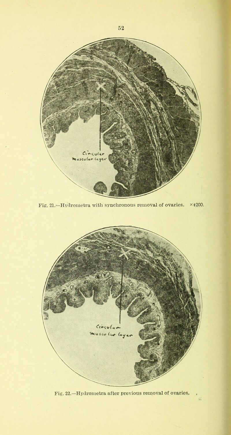 Fig. 21.—Hydrometra with synchronous removal of ovaries. xe200. Fig. 22.—Hydrometra after previous removal of ovaries.