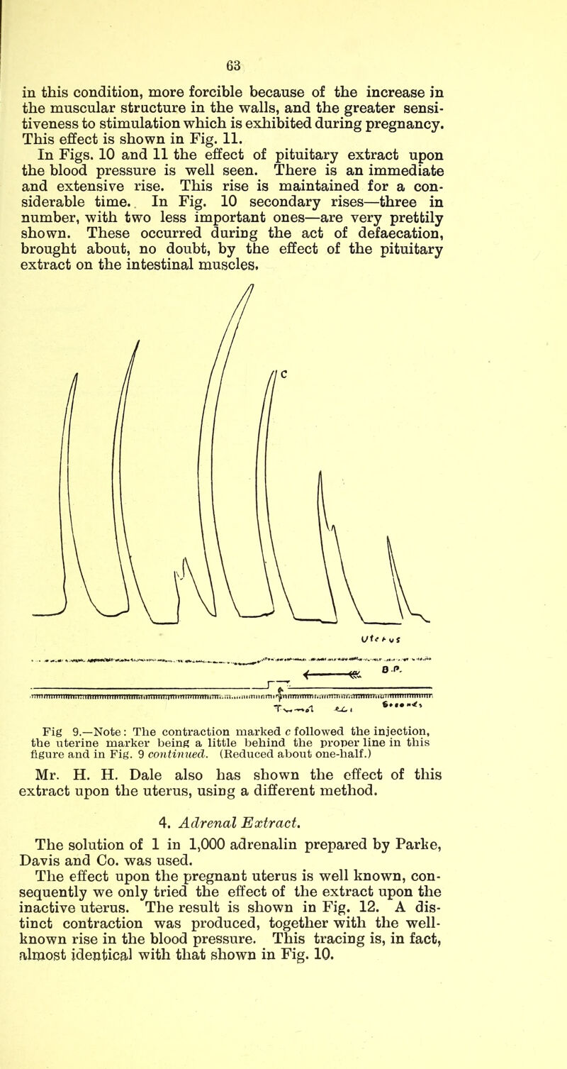 in this condition, more forcible because of the increase in the muscular structure in the walls, and the greater sensi- tiveness to stimulation which is exhibited during pregnancy. This effect is shown in Fig. 11. In Figs. 10 and 11 the effect of pituitary extract upon the blood pressure is well seen. There is an immediate and extensive rise. This rise is maintained for a con- siderable time. In Fig. 10 secondary rises—three in number, with two less important ones—are very prettily shown. These occurred during the act of defaecation, brought about, no doubt, by the effect of the pituitary extract on the intestinal muscles. Fig 9.—Note : The contraction marked c followed the injection, the uterine marker being a little behind the proper line in this figure and in Fig. 9 contimiecl. (Reduced about one-half.) Mr. H. H. Dale also has shown the effect of this extract upon the uterus, using a different method. 4. Adrenal Extract. The solution of 1 in 1,000 adrenalin prepared by Parhe, Davis and Co. was used. The effect upon the pregnant uterus is well known, con- sequently we only tried the effect of the extract upon the inactive uterus. The result is shown in Fig. 12. A dis- tinct contraction was produced, together with the well- known rise in the blood pressure. This tracing is, in fact, almost ideutical with that shown in Fig. 10.