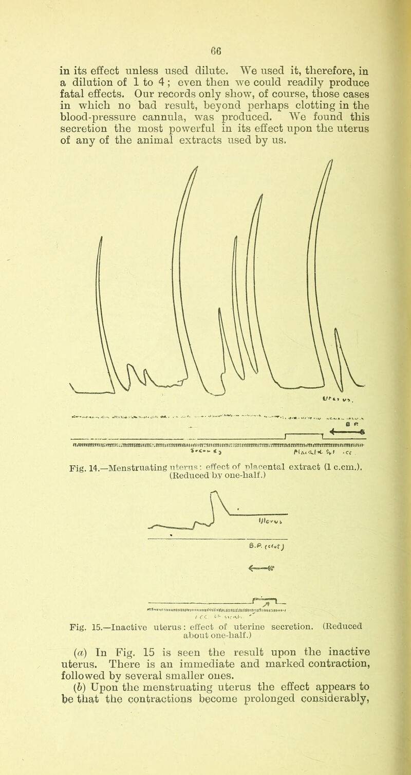 in its effect unless used dilute. We used it, therefore, in a dilution of 1 to 4; even then we could readily produce fatal effects. Our records only show, of course, those cases in which no bad result, beyond perhaps clotting in the blood-pressure cannula, was produced. We found this secretion the most powerful in its effect upon the uterus of any of the animal extracts used by us. iTiTnTiTTrnTirnnTTWti,itTnTnti»iTT»ri.iTtniinTniTirnirrt!itininitninnfi7sninnTnnrrnn;TninnTrtiTiTnnitTirtTnTnTTniTinrtnninn' «vr .Cf Fig_ 14,—Menstruating ntei'ns: effect of placental extract (1 c.cm.). (Reduced by one-half.) r ^ L_ ICC. 67- Fig. 15.—Inactive uterus: effect of uterine secretion. (Reduced about one-lialf.) {a) In Fig. 15 is seen the result upon the inactive uterus. There is an immediate and marked contraction, followed by several smaller ones. (6) Upon the menstruating uterus the effect appears to be that the contractions become prolonged considerably,