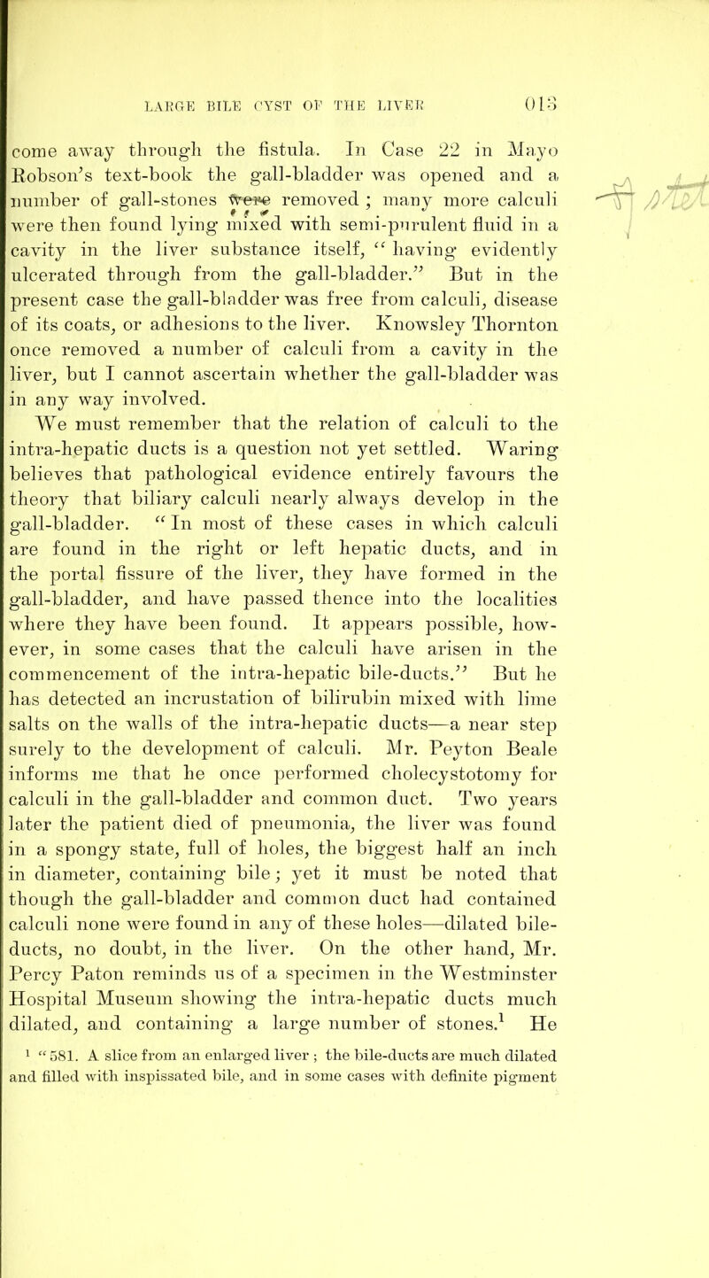 come away throngli the fistula. In Case 22 in Mayo Robson^s text-book the gall-bladder was opened and a ,, number of gall-stones Were removed ; many more calculi /)' were then found lying mixed with semi-purulent fluid in a cavity in the liver substance itself, having’ evidently ulcerated through from the gall-bladder.^^ But in the present case the gall-bladder was free from calculi, disease of its coats, or adhesions to the liver. Knowsley Thornton once removed a number of calculi from a cavity in the liver, but I cannot ascertain whether the gall-bladder was in any way involved. We must remember that the relation of calculi to the intra-hepatic ducts is a question not yet settled. Waring believes that pathological evidence entirely favours the theory that biliary calculi nearly always develop in the gall-bladder. In most of these cases in which calculi are found in the right or left hepatic ducts, and in the portal fissure of the liver, they have formed in the gall-bladder, and have passed thence into the localities where they have been found. It appears possible, how- ever, in some cases that the calculi have arisen in the commencement of the intra-hepatic bile-ducts.But he has detected an incrustation of bilirubin mixed with lime salts on the walls of the intra-hepatic ducts—a near step surely to the development of calculi. Mr. Peyton Beale informs me that he once performed cholecystotomy for calculi in the gall-bladder and common duct. Two years later the patient died of pneumonia, the liver was found in a spongy state, full of holes, the biggest half an inch in diameter, containing bile; yet it must be noted that though the gall-bladder and common duct had contained calculi none were found in any of these holes—dilated bile- ducts, no doubt, in the liver. On the other hand, Mr. Percy Paton reminds us of a specimen in the Westminster Hospital Museum showing the intra-hepatic ducts much dilated, and containing a large number of stones.^ He ^ “ 581. A slice from an enlarged liver ; the bile-dncts are much dilated and filled with inspissated bile, and in some cases with definite pigment