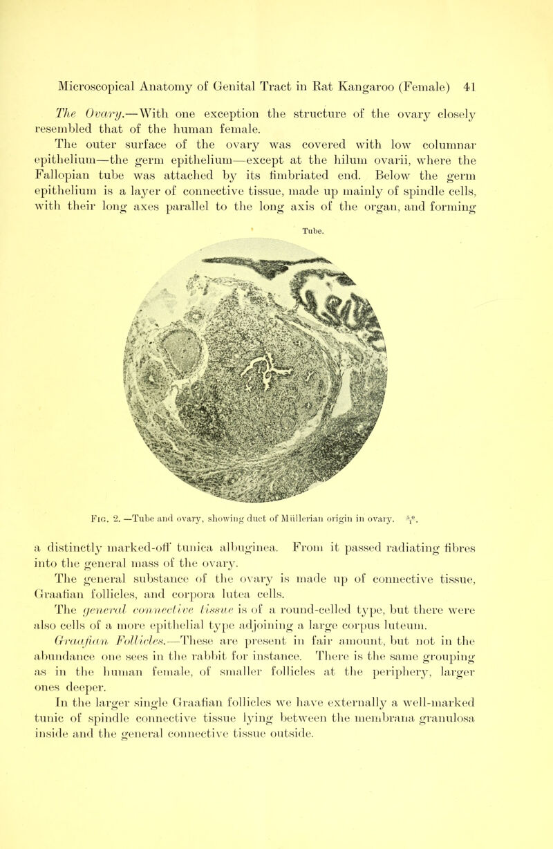 The Ovary.—With one exception the structure of the ovary closely resembled that of the human female. The outer surface of the ovary was covered with low columnar epithelium—the germ epitlielium—except at the liilum ovarii, where the Fallopian tube was attached by its fimbriated end. Below the germ epithelium is a layer of connective tissue, made up mainly of spindle cells, witli their long axes parallel to tlie long axis of the organ, and forming Tube. Fig. 2. —Tube and ovary, sliowiug duct of Millleriau origin in ovary, yb a distinctly marked-oil tunica allniginea. From it passed radiating fibres into the general mass of the ovary. Tlie general substance of tlie ovary is made up of connective tissue, Graahan follicles, and corpora lutea cells. The (jeneral convective tissue is of a round-celled type, but there were also cells of a more epithelial type adjoining a large corpus luteum. (r'lmifinn Fotticles.—Idtese are present in fair amount, but not in the abundance one sees in the rabbit for instance. There is the same grouping as in the human female, of smaller follicles at the periphery, larger ones deeper. In the larger single Graafian follicles we liave externally a well-marked tunic of spindle connective tissue lying between the membrana granulosa inside and the (general connective tissue outside.