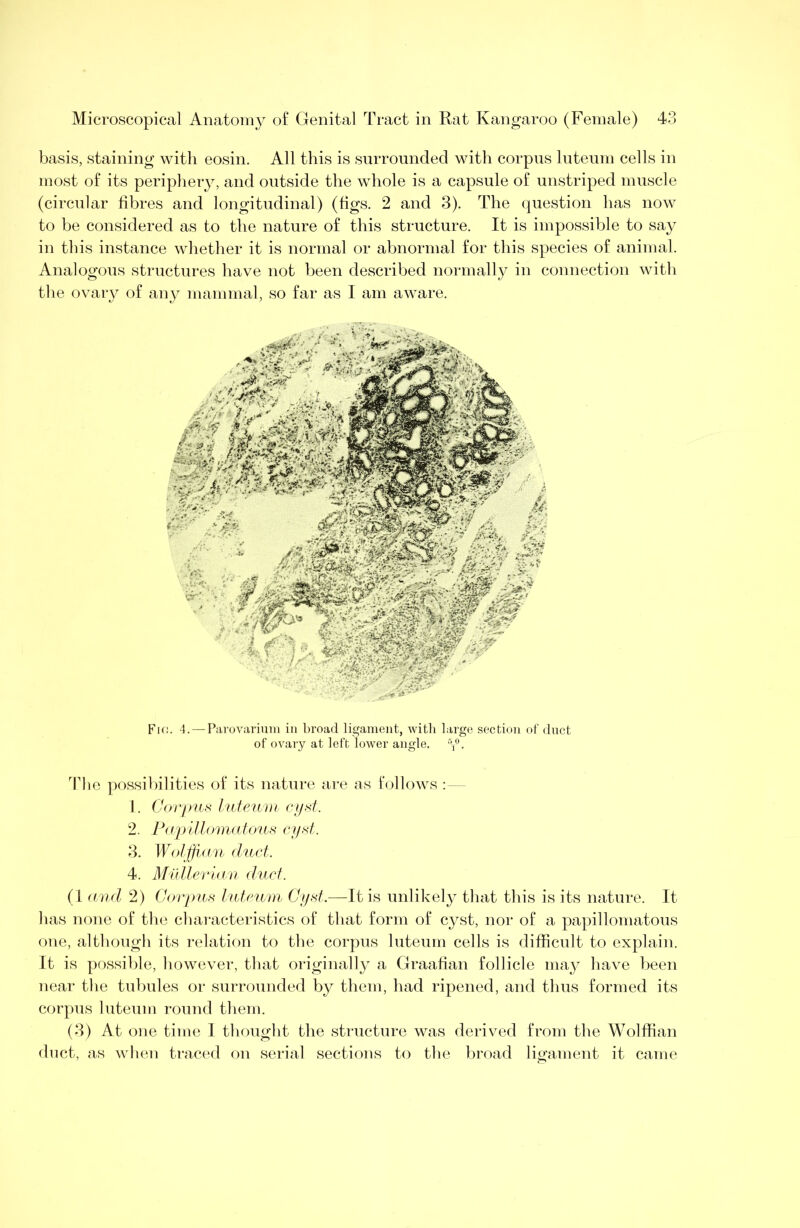 basis, staining with eosin. All this is surrounded with corpus luteum cells in most of its periphery, and outside the whole is a capsule of unstriped muscle (circular fibres and longitudinal) (figs. 2 and 3). The question has now to be considered as to the nature of this structure. It is impossible to say in this instance whether it is normal or abnormal for this species of animal. Analogous structures have not been described normally in connection with the ovary of any mammal, so far as I am aware. Fk;. 4. — Parovarium in broad ligament, witli large section of duct of ovary at left lower angle, y. The possilnlities of its nature are as fcjllows : — 1. Corpus lute u ni r i/st. 2. FiipilkmidUms cyst. 3. WolffiAin (hbct. 4. Millleriii n duct. (1 and 2) Carpus I/utiaini Cyst.—It is unlikely that this is its nature. It has none of the chai-acteristics of that form of cyst, nor of a papillomatous one, although its relation to the corpus luteum cells is difficult to explain. It is possible, however, that originally a Graafian follicle may have been near the tubules or surrounded by them, had ripened, and thus formed its corpus luteum round them. (3) At one time I thought the structure was derived from the Wolffian duct, as wlien traced on serial sections to the broad ligament it came
