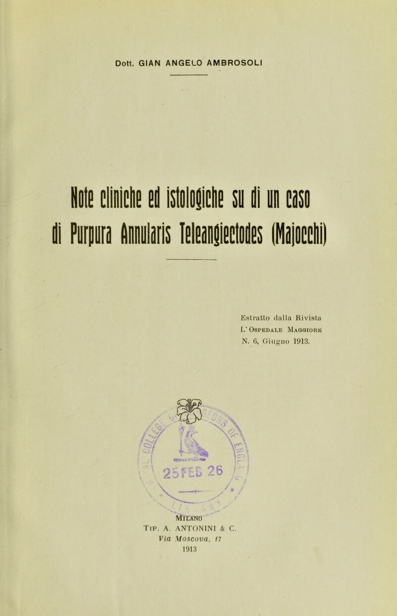 dille el istologiche su di un coso Estratto dalla Rivista L’ Ospedale Maggiore N. 6, Giugno 1913. Via Moscova, 17 1913