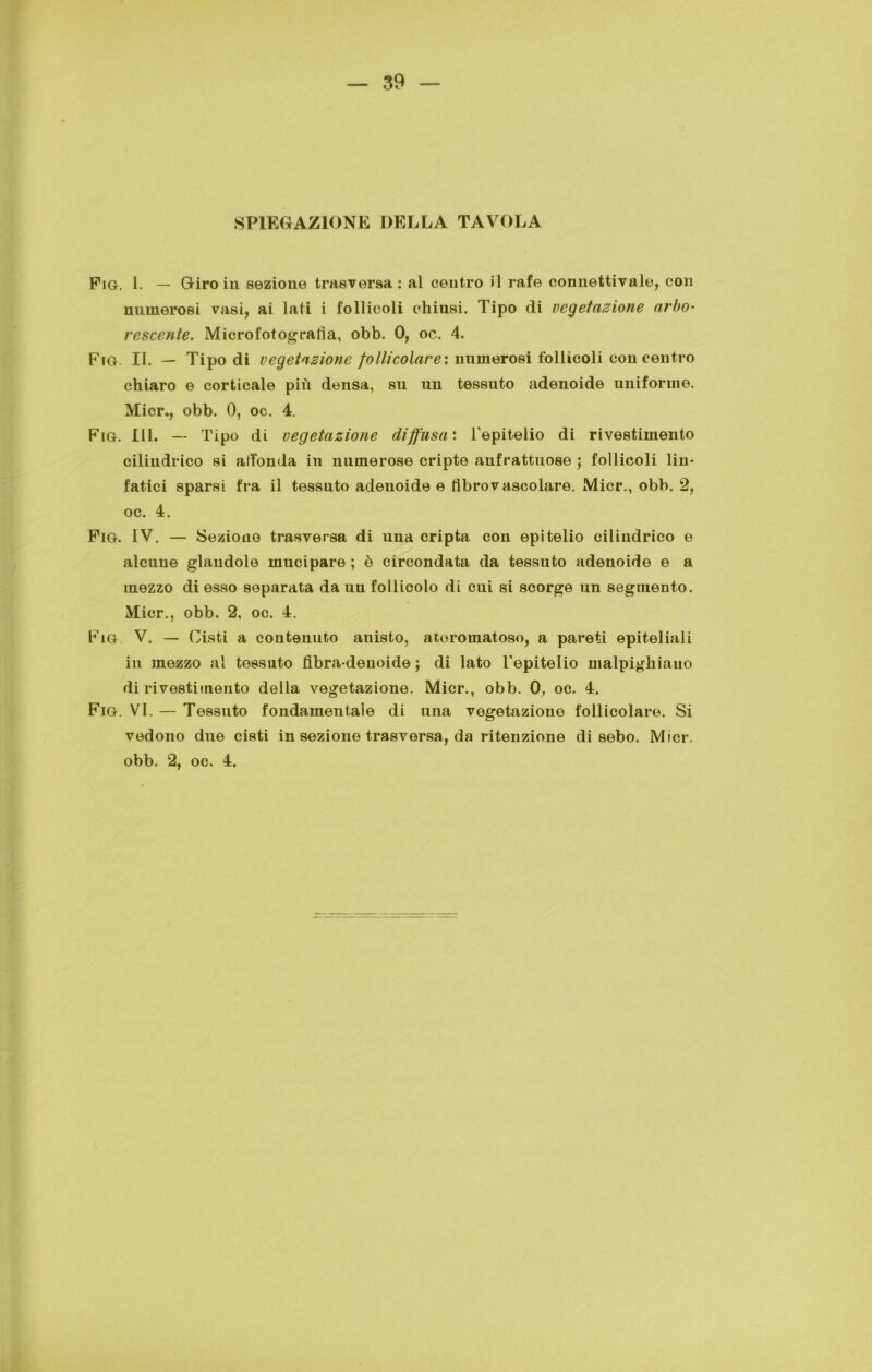 SPIEGAZIONE DELLA TAVOLA Fig. I. — Giro in sezione trasversa : al centro il rafe connettivale, con numerosi vasi, ai lati i follicoli chiusi. Tipo di vegetazione arbo- rescente. Microfotogratìa, obb. 0, oc. 4. Fig II. — Tipo di vegetazione follicolare: nnmerosi follicoli concentro chiaro e corticale più densa, su un tessuto adenoide uniforme. Micr., obb. 0, oc. 4. Fig. III. — Tipo di vegetazione diffusa', l'epitelio di rivestimento cilindrico si affonda in numerose cripte anfrattuose ; follicoli lin- fatici sparsi fra il tessuto adenoide e fibrovascolare. Mici*., obb. 2, oc. 4. Fig. IV. — Seziono trasversa di una cripta con epitelio cilindrico e alcune glaudole mucipare ; è circondata da tessuto adenoide e a mezzo di esso separata da un follicolo di cui si scorge un segmento. Micr., obb. 2, oc. 4. Fig V. — Cisti a contenuto anisto, ateromatoso, a pareti epiteliali in mezzo al tessuto flbra denoide ; di lato l’epitelio malpighiauo di rivestimento della vegetazione. Micr., obb. 0, oc. 4. Fig. VI. — Tessuto fondamentale di una vegetazione follicolare. Si vedono due cisti in sezione trasversa, da ritenzione di sebo. Micr. obb. 2, oc. 4.