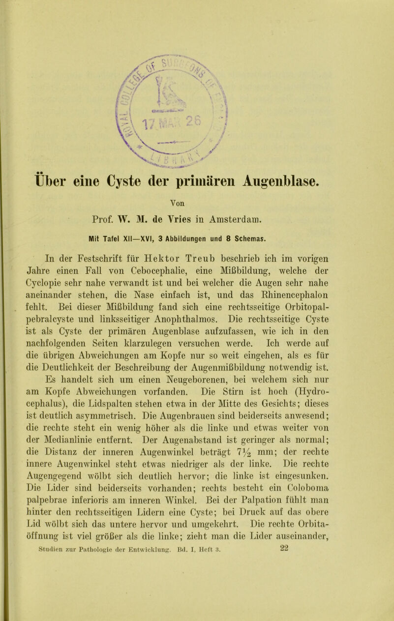 über eine Cyste der primären Augenblase. Von Prof. W. M. de Yries in Amsterdam. Mit Tafel XII—XVI, 3 Abbildungen und 8 Schemas. In der Festschrift für Hektor Trenb beschrieb ich im vorigen Jahre einen Fall von Cebocephalie, eine Mißbildung, welche der Cyclopie sehr nahe verwandt ist und bei welcher die Augen sehr nahe aneinander stehen, die Nase einfach ist, und das Phinencephalon fehlt. Bei dieser Mißbildung fand sich eine rechtsseitige Orbitopal- pebralcyste und linksseitiger Anophthalmos. Die rechtsseitige Cyste ist als Cyste der primären Augenblase aufzufassen, wie ich in den nachfolgenden Seiten klarzulegen versuchen werde. Ich werde auf die übrigen Abweichungen am Kopfe nur so weit eingehen, als es für die Deutlichkeit der Beschreibung der Augenmißbildung notwendig ist. Es handelt sich um einen Neugeborenen, bei welchem sich nur am Kopfe Abweichungen vorfanden. Die Stirn ist hoch (Hydro- cephalus), die Lidspalten stehen etwa in der Mitte des Gesichts; dieses ist deutlich asymmetrisch. Die Augenbrauen sind beiderseits anwesend; die rechte steht ein wenig höher als die linke und etwas weiter von der Medianlinie entfernt. Der Augenabstand ist geringer als normal; die Distanz der inneren Augenwinkel beträgt 7^ mm; der rechte innere Augenwinkel steht etwas niedriger als der linke. Die rechte Augengegend wölbt sich deutlich hervor; die linke ist eingesunken. Die Lider sind beiderseits vorhanden; rechts besteht ein Coloboma palpebrae inferioris am inneren W'inkel. Bei der Palpation fühlt man hinter den rechtsseitigen Lidern eine Cyste; bei Druck auf das obere Lid wölbt sich das untere hervor und umgekehrt. Die rechte Orbita- öffnung ist viel größer als die linke; zieht man die Lider auseinander, Studien zur Pathologie der Entwicklung. Bd. I, Heft :3. 22