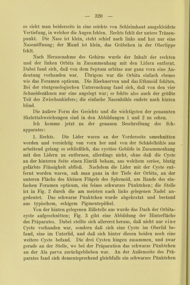 so sieht man beiderseits in eine seichte von Schleimhaut ausgekleidete Vertiefung, in welcher die Augen fehlen. Kechts fehlt der untere Tränen- punkt. Die Nase ist klein, steht schief nach links und hat nur eine Nasenöffnung; der Mund ist klein, das Grübchen in der Oberlippe fehlt. Nach Herausnahme des Gehirns wurde der Inhalt der rechten und der linken Orbita in Zusammenhang mit den Lidern entfernt. Dabei fand sich, daß von dem Septum orbitae nur ganz vorn eine An- deutung vorhanden war. Übrigens war die Orbita einfach ebenso wie das Foramen opticum. Die Riechnerven und dasEthmoid fehlten. Bei der röntgenologischen Untersuchung fand sich, daß von den vier Schneidezähnen nur eine angelegt war; es fehlte also auch der größte Teil des Zwischenkiefers; die einfache Nasenhöhle endete nach hinten blind. Die äußere Form des Gesichts und die wichtigsten der genannten Skelettabweichungen sind in den Abbildungen 1 und 2 zu sehen. Ich komme jetzt zu der genauen Beschreibung des Seh- apparates : 1. Rechts, Die Lider waren an der Vorderseite Umschnitten worden und vorsichtig von vorn her und von der Schädelhöhle aus arbeitend gelang es schließlich, das cystöse Gebilde in Zusammenhang mit den Lidern zu entfernen, allerdings nicht, ohne daß die Cyste an der hinteren Seite einen Einriß bekam, aus welchem seröse, blutig gefärbte Flüssigkeit abfloß. Nachdem die Lider mit der Cyste ent- fernt worden waren, sah man ganz in der Tiefe der Orbita, an der unteren Fläche des kleinen Flügels des Sphenoid, am Rande des ein- fachen Foramen opticum, ein feines schwarzes Pünktchen; die Stelle ist in Fig. 2 durch die am meisten nach links gelegenen Nadel an- gedeutet. Das schwarze Pünktchen wurde abgekratzt und bestand aus typischem, eckigem Pigmentepithel. Von der hinten gelegenen Rißstelle aus wurde das Dach der Orbita- cyste aufgeschnitten; Fig. 3 gibt eine Abbildung der Ilinterfläche des Präparates. Dabei stellte sich allererst heraus, daß nicht nur eine Cyste vorhanden war, sondern daß sich eine Cyste im Oberlid be- fand, eine im Unterlid, und daß sich hinter diesen beiden noch eine weitere Cyste befand. Die drei Cysten hingen zusammen, und zwar gerade an der Stelle, wo bei der Präparation das schwarze Pünktchen an der Ala parva zurückgeblieben war. An der Außenseite des Prä- parates fand sich dementsprechend gleichfalls ein schwarzes Pünktchen