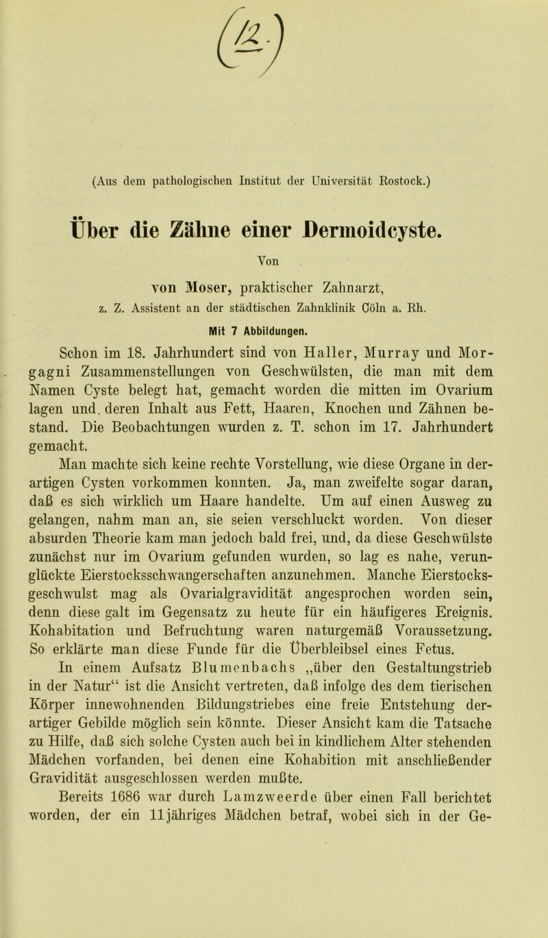 (Aus dem pathologischen Institut der Universität Rostock.) Über die Zähne einer Dermoidcyste. Von von Moser, praktischer Zahnarzt, z. Z. Assistent an der städtischen Zahnklinik Cöln a. Rh. Mit 7 Abbildungen. Schon im 18. Jahrhundert sind von Haller, Murray und Mor- gagni Zusammenstellungen von Geschwülsten, die man mit dem Namen Cyste belegt hat, gemacht worden die mitten im Ovarium lagen und. deren Inhalt aus Fett, Haaren, Knochen und Zähnen be- stand. Die Beobachtungen wurden z. T. schon im 17. Jahrhundert gemacht. Man machte sich keine rechte Vorstellung, wie diese Organe in der- artigen Cysten Vorkommen konnten. Ja, man zweifelte sogar daran, daß es sich wirklich um Haare handelte. Um auf einen Ausweg zu gelangen, nahm man an, sie seien verschluckt worden. Von dieser absurden Theorie kam man jedoch bald frei, und, da diese Geschwülste zunächst nur im Ovarium gefunden wurden, so lag es nahe, verun- glückte Eierstocksschwangerschaften anzunehmen. Manche Eierstocks- geschwulst mag als Ovarialgravidität angesprochen worden sein, denn diese galt im Gegensatz zu heute für ein häufigeres Ereignis. Kohabitation und Befruchtung waren naturgemäß Voraussetzung. So erklärte man diese Funde für die Überbleibsel eines Fetus. In einem Aufsatz Blumenbachs ,,über den Gestaltungstrieb in der Natur“ ist die Ansicht vertreten, daß infolge des dem tierischen Körper innewohnenden Bildungstriebes eine freie Entstehung der- artiger Gebilde möglich sein könnte. Dieser Ansicht kam die Tatsache zu Hilfe, daß sich solche Cysten auch bei in kindlichem Alter stehenden Mädchen vorfanden, bei denen eine Kohabition mit anschließender Gravidität ausgeschlossen werden mußte. Bereits 1686 war durch Lamzweerde über einen Fall berichtet worden, der ein 11 jähriges Mädchen betraf, wobei sich in der Ge-