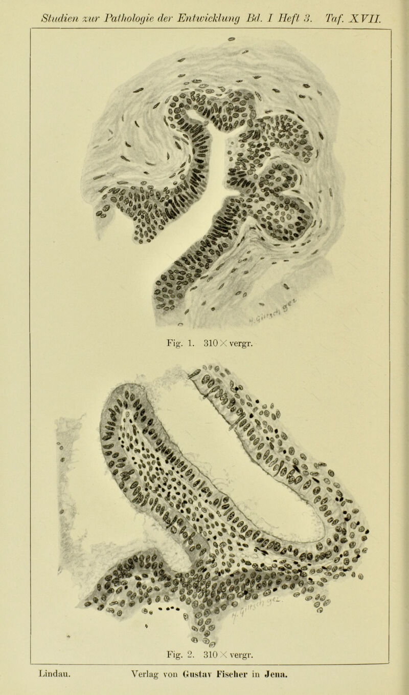 Studien zur Pathologie der Enhuicklung Bd. I Heft d. Taf. JCVIL & s?jS , i*U Fig. 1. SlOXvergr. Lindau. Verlag von (iiistav Fischer in Jena.