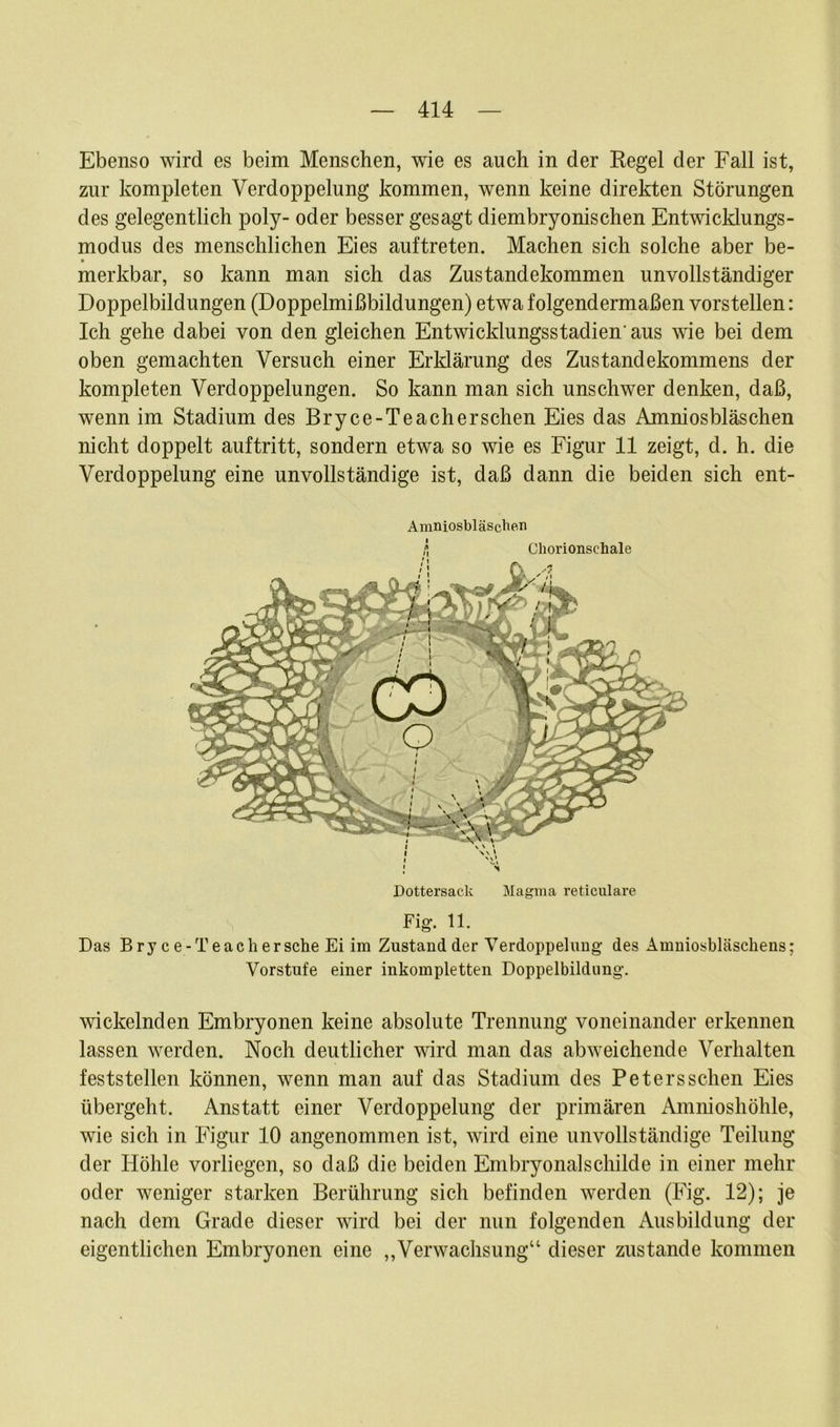 Ebenso wird es beim Menschen, wie es auch in der Regel der Fall ist, zur kompleten Verdoppelung kommen, wenn keine direkten Störungen des gelegentlich poly- oder besser gesagt diembryonischen Entwicklungs- modus des menschlichen Eies auftreten. Machen sich solche aber be- • merkbar, so kann man sich das Zustandekommen unvollständiger Doppelbildungen (Doppelmißbildungen) etwa folgendermaßen vorstellen: Ich gehe dabei von den gleichen Entwicklungsstadien' aus wie bei dem oben gemachten Versuch einer Erklärung des Zustandekommens der kompleten Verdoppelungen. So kann man sich unschwer denken, daß, wenn im Stadium des Bryce-Teacherschen Eies das Amniosbläschen nicht doppelt auftritt, sondern etwa so wie es Figur 11 zeigt, d. h. die Verdoppelung eine unvollständige ist, daß dann die beiden sich ent- Amniosbläschen Dottersack Magma reticulare Fi g. 11. Das Bry c e-Teachersche Ei im Zustand der Verdoppelung des Amniosbläschens; Vorstufe einer inkompletten Doppelbildung. wickelnden Embryonen keine absolute Trennung voneinander erkennen lassen werden. Noch deutlicher wird man das abweichende Verhalten feststellen können, wenn man auf das Stadium des Petersschen Eies übergeht. Anstatt einer Verdoppelung der primären Amnioshöhle, wie sich in Figur 10 angenommen ist, wird eine unvollständige Teilung der Höhle vorliegen, so daß die beiden Embryonal Schilde in einer mehr oder weniger starken Berührung sich befinden werden (Fig. 12); je nach dem Grade dieser wird bei der nun folgenden Ausbildung der eigentlichen Embryonen eine „Verwachsung“ dieser zustande kommen
