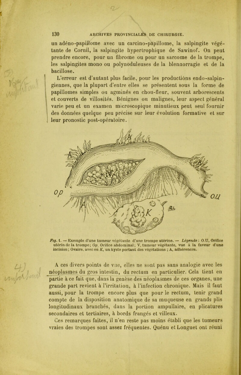 un adéno-papillome avec un carcino-papillome, la salpingite végé- tante de Cornil, la salpingite hypertrophique de Sawinof. On peut prendre encore, pour un fibrome ou pour un sarcome de la trompe, les salpingites mono ou polynoduleuses de la blennorragie et de la bacillose. L’erreur est d’autant plus facile, pour les productions endo-salpin- giennes, que la plupart d’entre elles se présentent sous la forme de papillomes simples ou agminés en chou-fleur, souvent arborescents et couverts de villosités. Bénignes ou malignes, leur aspect général varie peu et un examen microscopique minutieux peut seul fournir des données quelque peu précise sur leur évolution formative et sur leur pronostic post-opératoire. Fig. 1. — Exemple d’une tumeur végétante d’une trompe utérine. — Légende : O.U, Orifice utérin de la trompe; Op, Orifice abdominal ; V, tumeur végétante, vue à la faveur d’une incision; Ovaire, avec en K, un kyste portant des végétations ; A, adhérences. A ces divers points de vue, elles ne sont pas sans analogie avec les néoplasmes du gros intestin, du rectum en particulier. Gela tient en partie à ce fait que, dans la genèse des néoplasmes de ces organes, une grande part revient à l’irritation, à l’infection chronique. Mais il faut aussi, pour la trompe encore plus que pour le rectum, tenir grand compte de la disposition anatomique de sa muqueuse en grands plis longitudinaux branchés, dans la portion ampullaire, en plicatures secondaires et tertiaires, à bords frangés et villeux. Ces remarques faites, il n’en reste pas moins établi que les tumeurs vraies des trompes sont assez fréquentes. Quénu et Longuet ont réuni