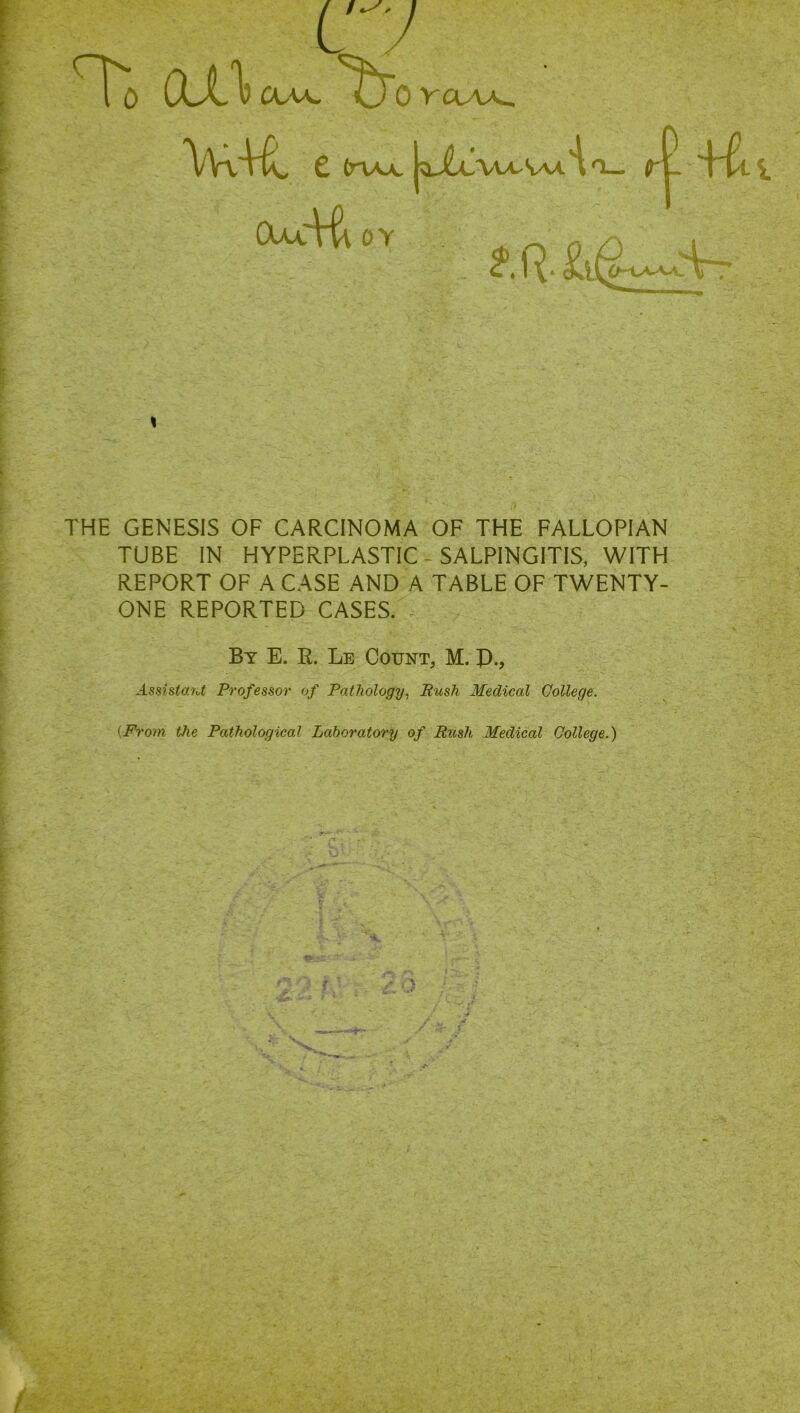 V To 0JL\ CWA. CTo VOAA_ £ (t\ax (Xu~Vu OY A/U^SyvA -l » THE GENESIS OF CARCINOMA OF THE FALLOPIAN TUBE IN HYPERPLASTIC SALPINGITIS, WITH REPORT OF A CASE AND A TABLE OF TWENTY- ONE REPORTED CASES. By E. R. Le Count, M. IX, Assista?U Professor of Pathology. Rush Medical College. [From the Pathological Laboratory of Rush Medical College.)