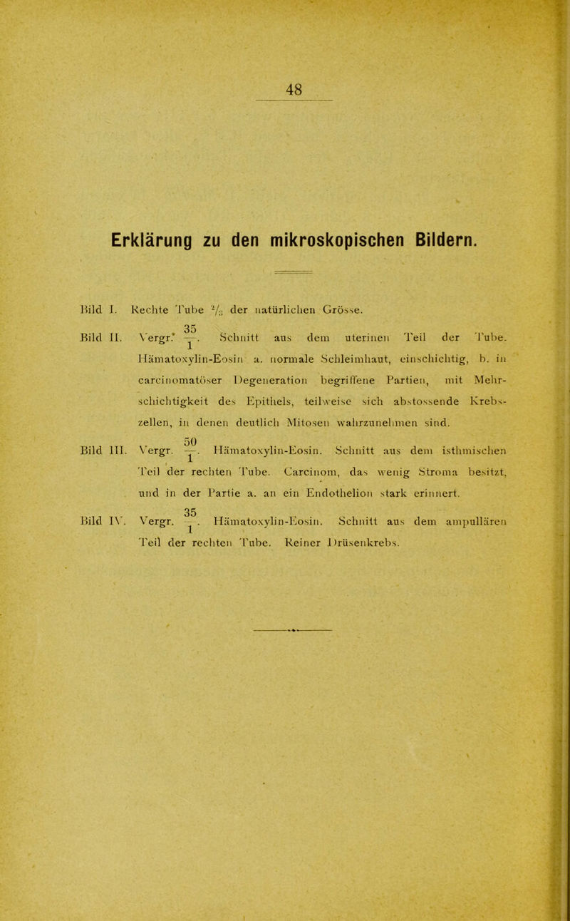 Erklärung zu den mikroskopischen Bildern. Bild J. Rechte 'Bube Vs der natürlichen Grösse. 35 Bild 11. Vergr.v —. Schnitt aus dem uterinen Teil der Tube. Hämatoxylin-Eosin a. normale Schleimhaut, einschichtig, b. in carcinomatöser Degeneration begriffene Partien, mit Mehr- schichtigkeit des Epithels, teilweise sich abstossende Krebs- zellen, in denen deutlich Mitosen wahrzunehmen sind. Bild 111. Bild IV. 50 \ ergr. —. Hämatoxylin-Eosin. Schnitt aus < 'Teil der rechten Tube. Carcinom, das wenig und in der Partie a. an ein Endothelion stark 35 Vergr. - . Hämatoxylin-Eosin. Schnitt aus Teil der rechten Tube. Reiner Drüsenkrebs. dem isthmischen Stroma besitzt, erinnert. dem ampullären