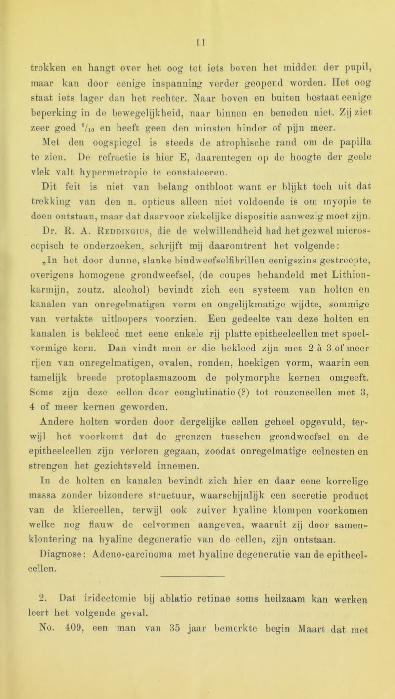 trokken en hangt over het oog tot iets boven het midden der pupil, maar kan door eenige inspanning vorder geopend worden. Het oog staat iets lager dan het rechter. Naar hoven en buiten bestaat eenigc beperking in de bewegelijkheid, naar binnen en beneden niet. Zij ziet zeer goed Vio en heeft geen den minsten hinder of pijn meer. Met den oogspiegel is steeds de atrophische rand om de papilla te zien. De refractie is hier E, daarentegen op de hoogte der geele vlek valt hyperinetropie te constateeren. Dit feit is niet van belang ontbloot want er blijkt toch uit dat trekking van den n. opticus alleen niet voldoende is om myopie te doen ontstaan, maar dat daarvoor ziekelijke dispositie aanwezig moet zijn. Dr. R. A. Reddixgiüs, die de welwillendheid had het gezwel micros- copisch te onderzoeken, schrijft mij daaromtrent het volgende: „In het door dunne, slanke bindweefselfibrillen eenigszins gestreepte, overigens homogene grondweefsel, (de coupes behandeld met Lithion- karmijn, zoutz. alcohol) bevindt zich een systeem van holten en kanalen van onregelmatigen vorm en ongelijkmatige wijdte, sommige van vertakte uitloopers voorzien. Een gedeelte van deze holten en kanalen is bekleed met eene enkele rij platte epitheelcellen met spoel- vormige kern. Dan vindt men er die bekleed zijn met 2 a 3 of meer rijen van onregelmatigen, ovalen, ronden, hoekigen vorm, waarin een tamelijk breede protoplasmazoom de polymorphe kernen omgeeft. Soms zijn deze cellen door conglutinatie (?) tot reuzencellen met 3, 4 of meer kernen geworden. Andere holten worden door dergelijke cellen geheel opgevuld, ter- wijl het voorkomt dat de grenzen tusschen grondweefsel en de epitheelcellen zijn verloren gegaan, zoodat onregelmatige celnesten en strengen het gezichtsveld innemen. In de holten en kanalen bevindt zich hier en daar eene korrelige massa zonder bizondere structuur, waarschijnlijk een secretie product van de kliercellen, terwijl ook zuiver hyaline klompen voorkomen welke nog flauw de celvormen aangeven, waaruit zij door samen- klontering na hyaline degeneratie van de cellen, zijn ontstaan. Diagnose: Adeno-carcinoma met hyaline degeneratie van do epitheel- cellen. 2. Dat iridectomie bij ablatio retinae soms heilzaam kan werken leert het volgende geval. No. 409, een man van 35 jaar liemerkte begin Maart dat met