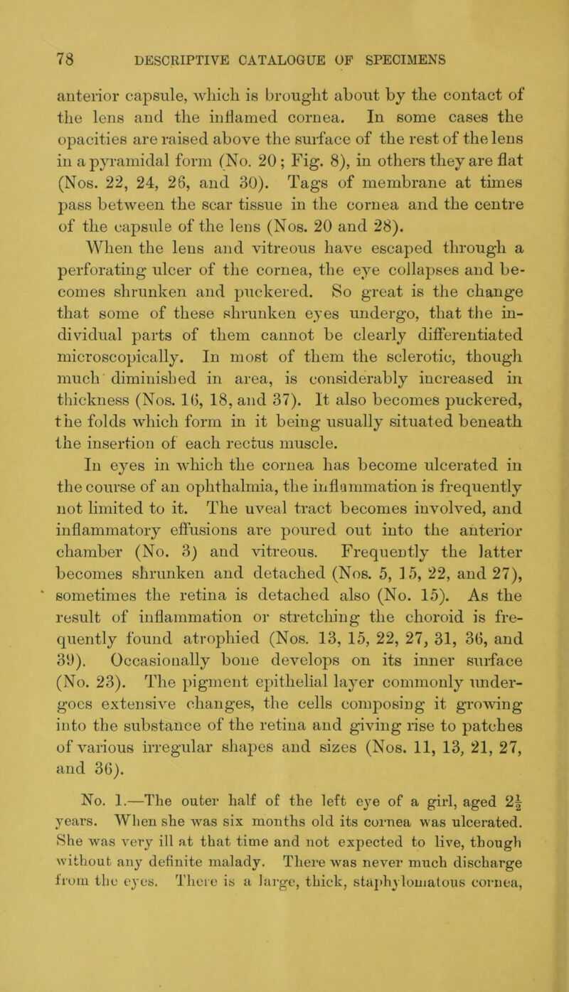 anteiior capsule, wliicli is brought about by the contact of the lens and the inflamed cornea. In some cases the opacities are raised above the surface of the rest of the lens in a pyramidal form (No. 20; Fig. 8), in others they are flat (Nos. 22, 24, 26, and 30). Tags of membrane at times pass between the scar tissue in the cornea and the centre of the capsule of the lens (Nos. 20 and 28). When the lens and vitreous have escaped through a perforating ulcer of the cornea, the eye collapses and be- comes shrunken and puckered. So great is the change that some of these shrunken eyes undergo, that tlie in- dividual parts of them cannot be clearly differentiated microscopically. In most of them the sclerotic, though much diminished in area, is considerably increased in thickness (Nos. 16, 18, and 37). It also becomes puckered, the folds which form in it being usually situated beneath the insertion of each rectus muscle. In eyes in which the cornea has become ulcerated in the course of an ophthalmia, the inflammation is frequently not limited to it. The uveal tract becomes involved, and inflammatory effusions are poured out into the anterior chamber (No. 3) and ^dtreou8. Frequently the latter becomes shrunken and detached (Nos. 5, 15, 22, and 27), ' sometimes the retina is detached also (No. 15). As the result of inflammation or stretching the choroid is fre- quently found atrophied (Nos. 13, 15, 22, 27, 31, 36, and 39). Occasionally bone develops on its inner surface (No. 23). The pigment epithelial layer commonly under- goes extensive changes, the cells composing it growing into the substance of the retina and giving rise to patches of various irregular shapes and sizes (Nos. 11, 13, 21, 27, and 36). No. 1.—The outer half of the left e^-e of a girl, aged 2| years. When she was six months old its cornea was ulcerated. She was very ill at that time and not expected to live, though without any deflnite malady. There was never much discharge from the tyes. Theie is a large, thick, stajAiylomatous cornea.