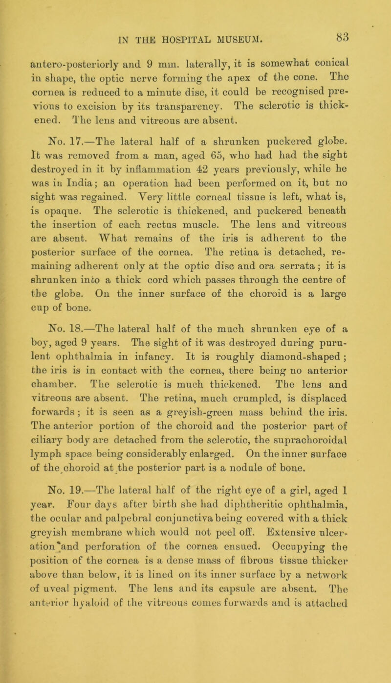 antero-posteriorly and 9 mm. laterally, it is somewhat conical in shape, the optic nerve forming the apex of the cone. The cornea is reduced to a minute disc, it could be recognised pre- vious to excision by its transparency. The sclerotic is thick- ened. The lens and vitreous are absent. No. 17.—The lateral half of a shrunken puckered globe. It was removed from a man, aged 65, who had had the sight destroyed in it by inflammation 42 years previously, while he was in India; an operation had been performed on it, but no sight was regained. Very little corneal tissue is left, what is, is opaque. The sclerotic is thickened, and puckered beneath the insertion of each rectus muscle. The lens and vitreous are absent. What remains of the iris is adherent to the posterior surface of the cornea. The retina is detached, re- maining adherent only at the optic disc and ora serrata; it is shrunken into a thick cord which passes through the centre of the globe. On the inner surface of the choroid is a large cup of bone. No. 18.—The lateral half of the much shrunken eye of a boy, aged 9 years. The sight of it was destroyed during puru- lent ophthalmia in infancy. It is roughly diamond-shaped ; the iris is in contact with the cornea, there being no anterior chamber. The sclerotic is much thickened. The lens and vitreous are absent. The retina, much crumpled, is displaced forwards ; it is seen as a greyish-green mass behind the iris. The anterior portion of the choroid and the posterior part of ciliary body are detached from the sclerotic, the suprachoroidal lymph space being considerably enlarged. On the inner surface of the choroid at the posterior part is a nodule of bone. No. 19.—The lateral half of the right eye of a girl, aged 1 year. Four days after birth she had diphtheritic ophthalmia, the ocular and palpebral conjunctiva being covered with a thick greyhsh membrane which would not peel off. Extensive ulcer- ation'and perforation of the cornea ensued. Occupying the position of the cornea is a dense mass of fibrous tissue thicker above than below, it is lined on its inner surface by a network of uveal pigment. The lens and its ca})sule are absent. The anterior hyaloid of the vitreous conics forwards and is attached
