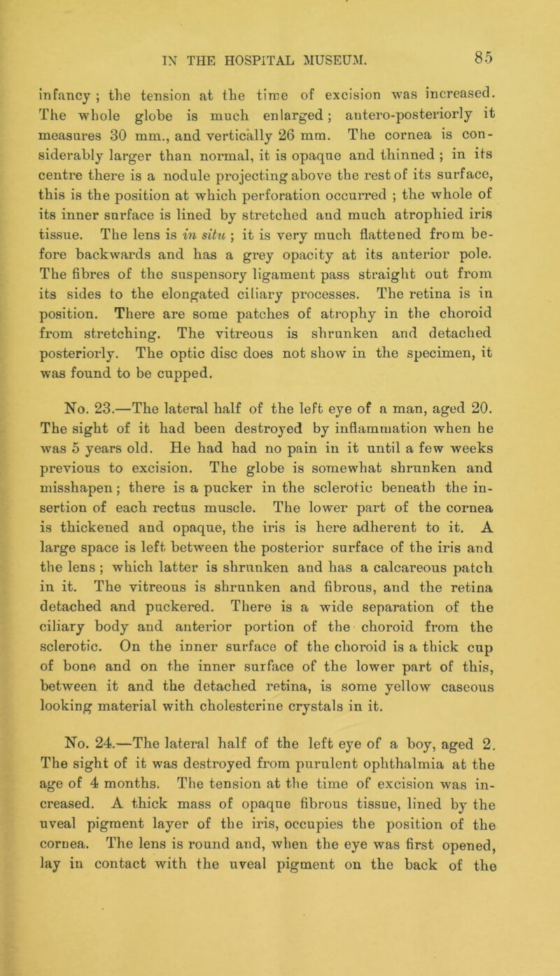 infancy ; the tension at the time of excision was increased. The whole globe is much enlarged; antero-posteriorly it measures 30 mm., and vertically 26 mm. The cornea is con- siderably larger than normal, it is opaque and thinned ; in its centre there is a nodule projecting above the rest of its surface, this is the position at which perforation occurred ; the whole of its inner surface is lined by stretched and much atrophied iris tissue. The lens is in situ ; it is very much flattened from be- fore backwards and has a grey opacity at its anterior pole. The fibres of the suspensory ligament pass straight out from its sides to the elongated ciliary processes. The retina is in position. There are some patches of atrophy in the choroid from stretching. The vitreous is shrunken and detached posteriorly. The optic disc does not show in the specimen, it was found to be cupped. No. 23.—The lateral half of the left eye of a man, aged 20. The sight of it had been destroyed by inflammation when he was 5 years old. He had had no pain in it until a few weeks previous to excision. The globe is somewhat shrunken and misshapen; there is a pucker in the sclerotic beneath the in- sertion of each rectus muscle. The lower part of the cornea is thickened and opaque, the iris is here adherent to it. A large space is left between the posterior surface of the iris and the lens ; which latter is shrunken and has a calcareous patch in it. The vitreous is shrunken and fibrous, and the retina detached and puckered. There is a wide separation of the ciliary body and anterior portion of the choroid from the sclerotic. On the inner surface of the choroid is a thick cup of bone and on the inner surface of the lower part of this, between it and the detached retina, is some yellow caseous looking material with cholesterine crystals in it. No. 24.—The lateral half of the left eye of a boy, aged 2. The sight of it was destroyed from purulent ophthalmia at the age of 4 months. The tension at the time of excision was in- creased. A thick mass of opaque fibrous tissue, lined by the uveal pigment layer of the iris, occupies the position of the cornea. The lens is round and, when the eye was first opened, lay in contact with the uveal pigment on the back of the