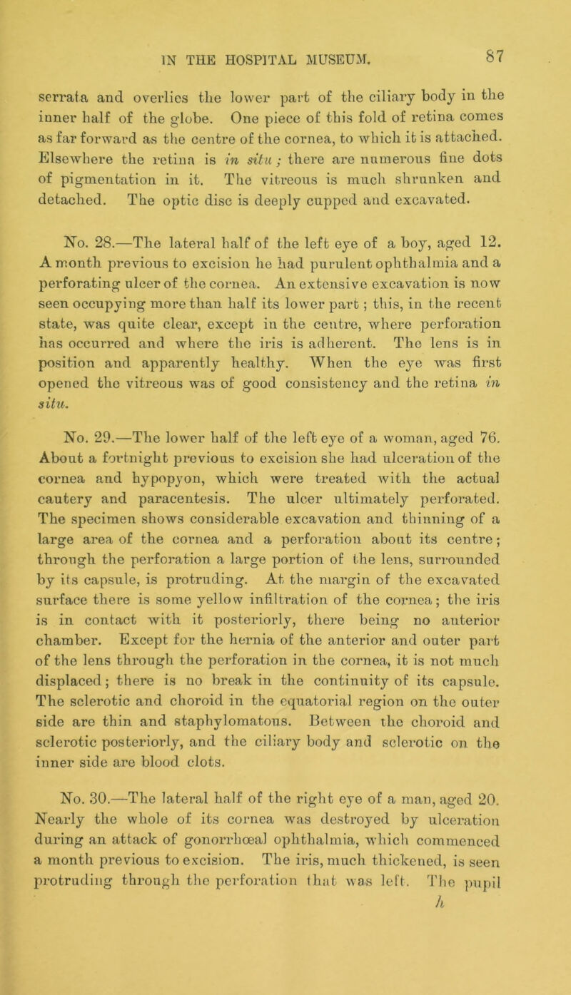 serraia and overlies the lower part of the ciliary body in the inner half of the globe. One piece of this fold of retina comes as far forward as the centre of the cornea, to which it is attached. Elsewhere the retina is in situ ; there are numerous fine dots of pigmentation in it. The vitreous is much shrunken and detached. The optic disc is deeply cupped and excavated. No. 28.—The lateral half of the left eye of a boy, aged 12. A month previous to excision he had purulent ophthalmia and a perforating ulcer of the cornea. An extensive excavation is now seen occupying more than half its lower part; this, in the recent state, was quite clear, except in the centre, where perforation has occurred and where the iris is adherent. The lens is in position and apparently healthy. When the eye was first opened the vitreous was of good consistency aud the retina in situ. No. 29.—The lower half of the left eye of a woman, aged 76. About a fortnight previous to excision she had ulceration of the cornea and hypopyon, which were treated with the actual cautery and paracentesis. The ulcer ultimately perforated. The specimen shows considerable excavation and thinning of a large area of the cornea and a perforation about its centre; through the perforation a large portion of the lens, surrounded by its capsule, is protruding. At the margin of the excavated surface there is some yellow infiltration of the cornea; tlie ii-is is in contact with it posteriorly, there being no anterior chamber. Except for the heimia of the anterior and outer pai’t of the lens through the perforation in the cornea, it is not much displaced; there is no break in the continuity of its capsule. The sclerotic and choroid in the equatorial region on the outer side are thin and staphylomatous. Between the choroid and sclerotic posteriorly, and the ciliary body and sclerotic on the inner side are blood clots. No. .30.—The lateral half of the right eye of a man, aged 20. Nearly the whole of its cornea was destroyed by ulcei-ation during an attack of gonorrhoeal ophthalmia, which commenced a month previous to excision. The iris, much thickened, is seen protruding through the perforation that was left. The pupil h