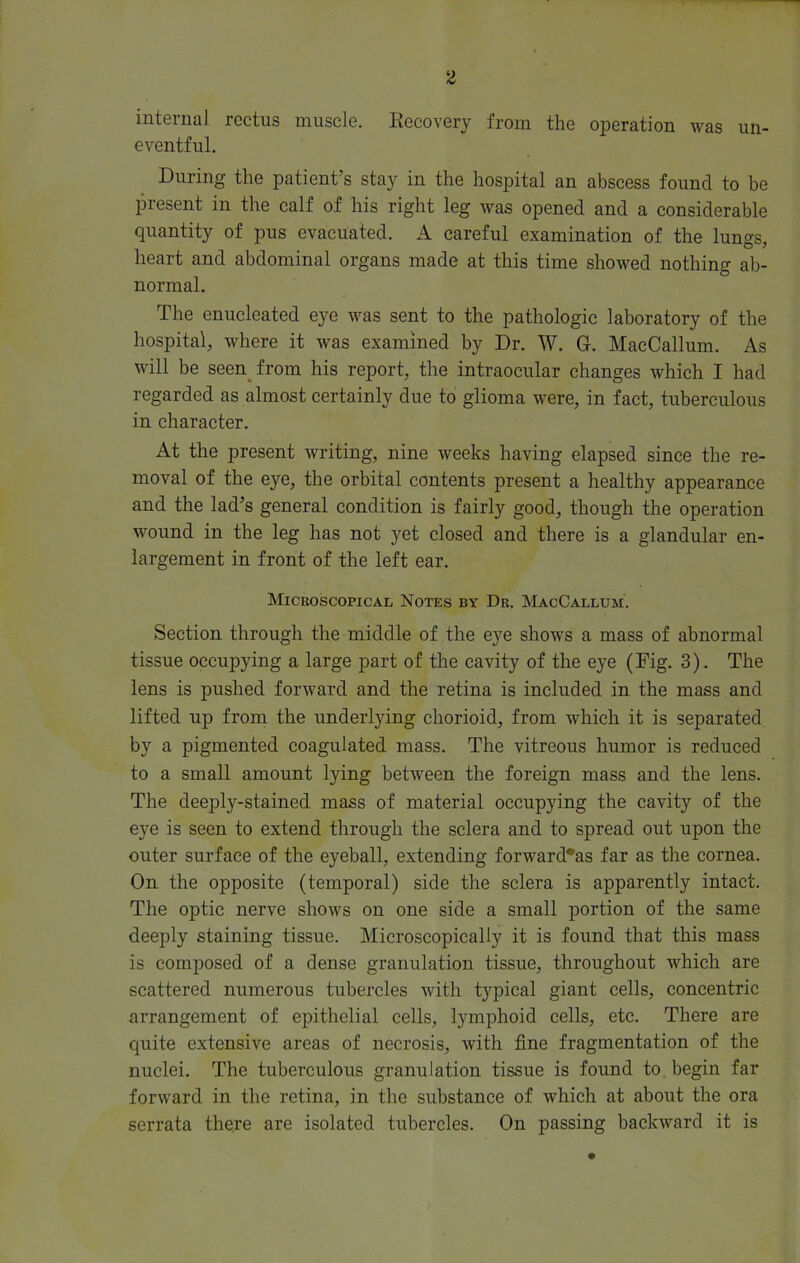 2 internal rectus muscle. Recovery from the operation was un- eventful. During the patient’s stay in the hospital an abscess found to be present in the calf of his right leg was opened and a considerable quantity of pus evacuated. A careful examination of the lungs, heart and abdominal organs made at this time showed nothing ab- normal. The enucleated eye was sent to the pathologic laboratory of the hospital, where it was examined by Dr. W. G. MacCallum. As will be seen from his report, the intraocular changes which I had regarded as almost certainly due to glioma were, in fact, tuberculous in character. At the present writing, nine weeks having elapsed since the re- moval of the eye, the orbital contents present a healthy appearance and the lad’s general condition is fairly good, though the operation wound in the leg has not yet closed and there is a glandular en- largement in front of the left ear. Microscopical Notes by Dr. MacCallum. Section through the middle of the eye shows a mass of abnormal tissue occupying a large part of the cavity of the eye (Fig. 3). The lens is pushed forward and the retina is included in the mass and lifted up from the underlying chorioid, from which it is separated by a pigmented coagulated mass. The vitreous humor is reduced to a small amount lying between the foreign mass and the lens. The deeply-stained mass of material occupying the cavity of the eye is seen to extend through the sclera and to spread out upon the outer surface of the eyeball, extending forward*as far as the cornea. On the opposite (temporal) side the sclera is apparently intact. The optic nerve shows on one side a small portion of the same deeply staining tissue. Microscopically it is found that this mass is composed of a dense granulation tissue, throughout which are scattered numerous tubercles with typical giant cells, concentric arrangement of epithelial cells, lymphoid cells, etc. There are quite extensive areas of necrosis, with fine fragmentation of the nuclei. The tuberculous granulation tissue is found to begin far forward in the retina, in the substance of which at about the ora serrata there are isolated tubercles. On passing backward it is
