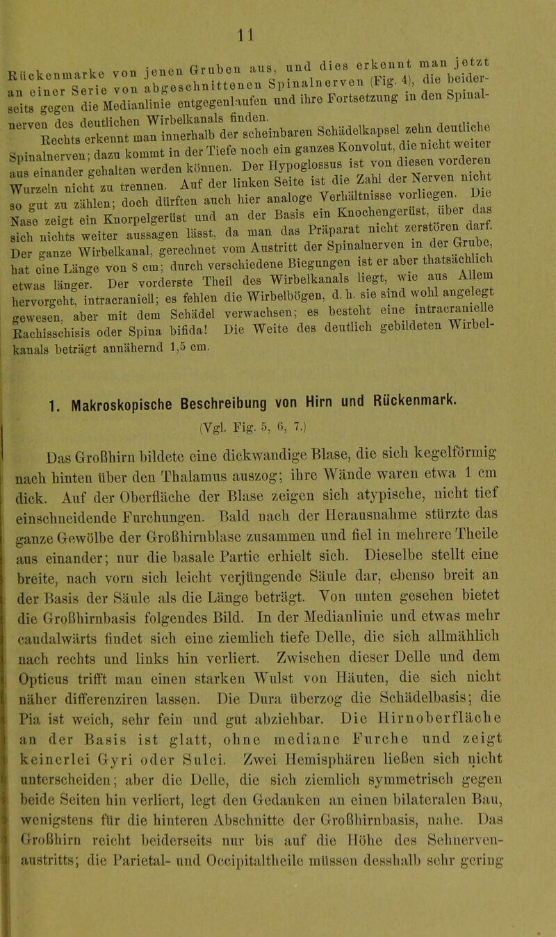 von abgeschnittenen s\)inalnerven (Fig. 4), die beid^^^^^ ;eit. gegen die Medianlinie entgegenlanfen und il.re Forteetamg m den Spmal- SDinalnerven- dazu kommt in der Tiefe noch ein ganzes Konvolut die nicht weitei ■L dnander gehalten werden können. Der Hypoglossus ist von diesen vorderen Wmzernichfzu trennen. Auf der linken Seite ist die Zahl der Nerven nich so gut zu zählen; doch dürften auch hier analoge Verhältnisse vorliegen. i Nas^e zeigt ein Knorpelgerüst und an der Basis ein Knochengerüst über das .ich uicht. weiter auseageu lässt, da urau das Präparat mcht ^ Der gause Wirbelkanal, gerechnet vom Austritt der Spinalnerven hat oL Länge von 8 cm; durch verschiedene Biegungen ist er aber “ etwas langer Der vorderste Theii des Wirbelkauals hegt,^ wie aus Allem hervorgeht, intracranieU; es fehlen die WirbelbBgen, d. h. sie sind wohl angelegt gewesen, aber mit dem Schädel verwachsen; es besteht eine introcramello Kachlsscbisis oder Spina biüda! Die Weite des deutlich gebildeten Wirbel- kanals beträgt annähernd 1,5 cm. 1. Makroskopische Beschreibung von Hirn und Rückenmark. (Vgl. Fig. 5, ß, 7.) Das Großhirn bildete eine dickwandige Blase, die sich kegelförmig I nach hinten ilher den Thalamns anszog; ihre Wände waren etwa 1 cm dick. Auf der Oberfläche der Blase zeigen sich atypische, nicht tief einschneidende Furchungen. Bald nach der Herausnahme stürzte das ganze Gewölbe der Großhirnblase zusammen und fiel in mehrere Theile aus einander; nur die basale Partie erhielt sich. Dieselbe stellt eine breite, nach vorn sich leicht verjüngende Säule dar, ebenso breit an der Basis der Säule als die Länge beträgt. Von unten gesehen bietet die Großhirnbasis folgendes Bild. In der Medianlinie und etwas mehr caudalwärts findet sich eine ziemlich tiefe Delle, die sich allmählich nach rechts und links hin verliert. Zwischen dieser Delle und dem Opticus trifft mau einen starken Wulst von Häuten, die sich nicht näher differenziren lassen. Die Dura überzog die Schädelbasis; die Pia ist weich, sehr fein und gut abziehbar. Die Hirnoberfläche an der Basis ist glatt, ohne mediane Furche und zeigt keinerlei Gyri oder Sulci. Zwei Hemisphären ließen sich nicht unterscheiden; aber die Delle, die sich ziemlich symmetrisch gegen I beide Seiten hin verliert, legt den Gedanken an einen bilateralen Bau, i wenigstens für die hinteren Abschnitte der Großhirnl)asis, nahe. Das ’J Großhirn reicht beiderseits nur bis auf die Höhe des Sehnerven- 4: austritts; die Parietal- und Occipitaltheile müssen desshalb selir gering