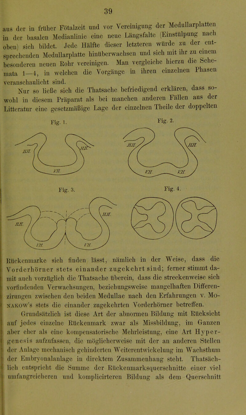 aus der in früher Fötalzeit und vor Vereinigung der Medullarplatten in der basalen Medianlinie eine neue Längsfalte (Einstülpung nach oben) sich bildet. Jede Hälfte dieser letzteren würde zu der ent- sprechenden Medullarplatte hinüberwachsen und sich mit ihr zu einem besonderen neuen Rohr vereinigen. Man vergleiche hierzu die Sche- mata 1—4, in welchen die Vorgänge in ihren einzelnen Phasen veranschaulicht sind. Nur so ließe sich die Thatsache befriedigend erklären, dass so- wohl in diesem Präparat als bei manchen anderen Fällen aus der Litteratur eine gesetzmäßige Lage der einzelnen Theile der doppelten Fig. 1. Fig. 2. Rückenraarke sich finden lässt, nämlich in der Weise, dass die i Vorderhörner stets einander zugekehrt sind; ferner stimmt da- j mit auch vorzüglich die Thatsache tiberein, dass die streckenweise sich 1 vorfindenden Verwachsungen, beziehungsweise mangelhaften Differen- i zirungen zwischen den beiden Medullae nach den Erfahrungen v. Mo- i NAKOw’s stets die einander zugekehrten Vorderhörner betreffen. ' Grundsätzlich ist diese Art der abnormen Bildung mit Rücksicht 1 auf jedes einzelne Rückenmark zwar als Missbildung, im Ganzen f aber eher als eine kompensatorische Mehrleistung, eine Art Hyper- 1 genesis aufzufassen, die möglicherweise mit der an anderen Stellen * der Anlage mechanisch gehinderten Weiterentwickelung im Wachsthum 1 der Embryonalanlage in direktem Zusammenhang stellt. Thatsäch- 4 lieh entspricht die Summe der Rtickeumarksipierschnitte einer viel i umfangreicheren und komplicirtcren Bildung als dem Querschnitt