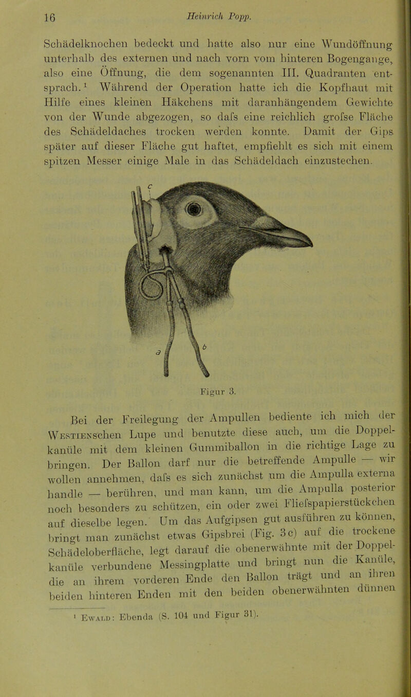 Schadelknochen bedeckt imd hatte also nur eiue Wmiddffnung unterhalb des externen und nach vorn voin hinteren Bogengange^ also eine Offnuug, die dem sogenannten III. Quadranten ent- sprach.^ Wahrend der Operation hatte ich die Kopfhaut mit Hilfe eines kleinen Hakchens mit daranhangendem Gewichte von der Wnnde abgezogen, so dafs eine reichlich grofse Flache des Scliadeldaches trocken wei'den konnte. Damit der Gips. spater auf dieser Flache gut haftet, empfiehlt es sich mit einem spitzen Messer einige Male in das Schadeldach einzustechen. Figur 3. Bei der Freilegung der Ampullen bediente ich mich der WusTiENschen Lupe und benutzte diese auch, uni die Doppel- kaniile mit dem kleinen Gummiballon in die richtige Lage zu bringen. Der Ballon darf nur die betreffende Ampulle — wir wollen annehmen, dais es sich zunachst urn die Ampulla externa handle — beriihren, und man kann, um die Ampulla posterior noch besonders zu schtitzen, ein oder zwei Fliefspapierstiickchen auf dieselbe legen. Um das Aufgipsen gut ausfiihren zu konnen, bringt man zunachst etwas Gipsbrei (Fig. 3 c) auf die ti^ckene Schadeloberflache, legt darauf die obenerwahnte mit der Doppe - kaniile verbundene Messingplatte und bringt nun die Kanule, die an ihrem vorderen Ende den Ballon triigt und an ihren beiden hinteren Enden mit den beiden obenerwahnten dunnen ' Ewai.d: El)enda (S. 104 und Figur 31). t