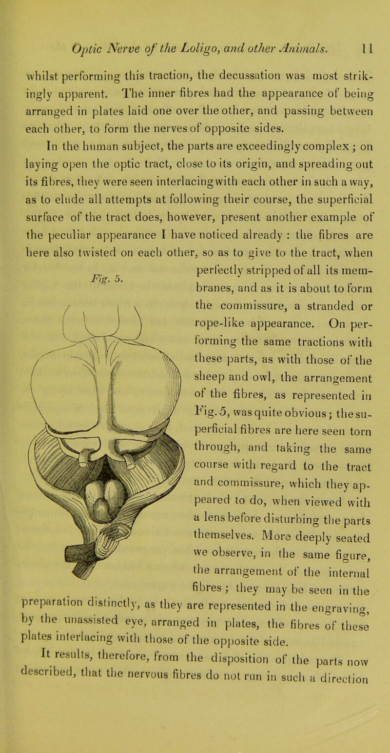 whilst performing this traction, the decussation was most strik- ingly apparent. The inner fibres had the appearance of being arranged in plates laid one over the other, and passing between each other, to form the nerves of opposite sides. In the human subject, the parts are exceedingly complex ; on laying open the optic tract, close to its origin, and spreading out its fibres, they were seen interlacingwith each other in such away, as to elude all attempts at following their course, the superficial surface of the tract does, however, present another example of the peculiar appearance I have noticed already : the fibres are here also twisted on each other, so as to give to the tract, when perfectly stripped of all its mem- branes, and as it is about to form the commissure, a stranded or rope-like appearance. On per- forming the same tractions with these parts, as with those of the sheep and owl, the arrangement of the fibres, as represented in Fig. 5, was quite obvious j the su- perficial fibres are here seen torn through, and taking the same course with regard to the tract and commissure, which they ap- peared to do, when viewed with a lens before disturbing the parts themselves. More deeply seated we observe, in the same figure, the arrangement of the internal fibres; they may be seen in the preparation distinctly, as they are represented in the engraving, by the unassisted eye, arranged in plates, the fibres of these plates interlacing with those of the opposite side. It results, therefore, from the disposition of the parts now described, that the nervous fibres do not run in such a direction