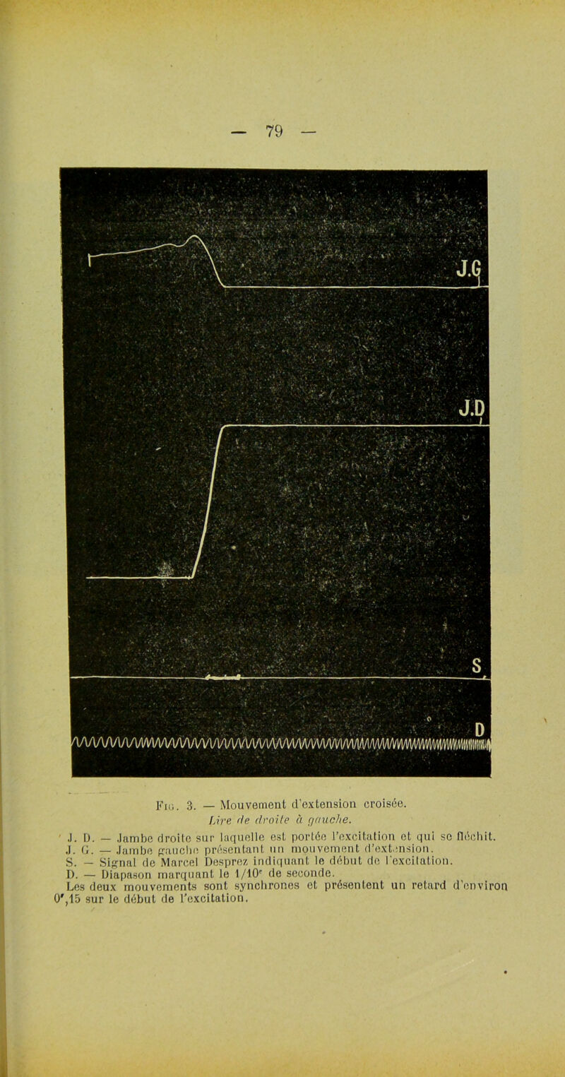 Fiü. 3. — Mouvement d'extension croisée. Lire de droite à gauche. J. D. — Jambe droite sur laquelle est portée l'excitation et qui se fléchit. J. G. — Jambe franche présentant un mouvement d’extension. S. — Signal de Marcel Desprez indiquant le début do l'excitation. D. — Diapason marquant le l/10r de seconde. Les deux mouvements sont synchrones et présentent un retard d'environ 0',15 sur le début de l’excitation.