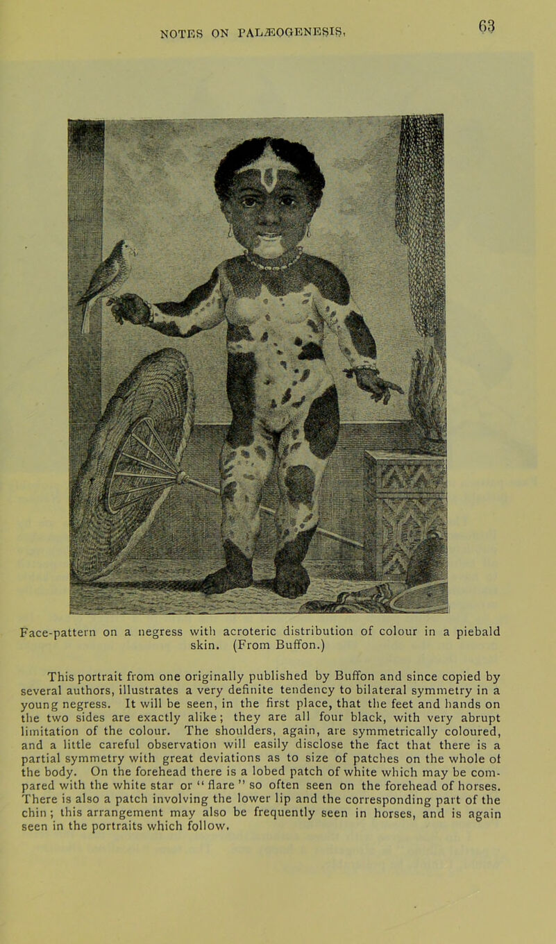 Face-pattern on a negress with acroteric distribution of colour in a piebald skin. (From Buffon.) This portrait from one originally published by Buffon and since copied by several authors, illustrates a very definite tendency to bilateral symmetry in a young negress. It will be seen, in the first place, that the feet and hands on the two sides are exactly alike; they are all four black, with very abrupt limitation of the colour. The shoulders, again, are symmetrically coloured, and a little careful observation will easily disclose the fact that there is a partial symmetry with great deviations as to size of patches on the whole of the body. On the forehead there is a lobed patch of white which may be com- pared with the white star or “ flare ” so often seen on the forehead of horses. There is also a patch involving the lower lip and the corresponding part of the chin; this arrangement may also be frequently seen in horses, and is again seen in the portraits which follow.