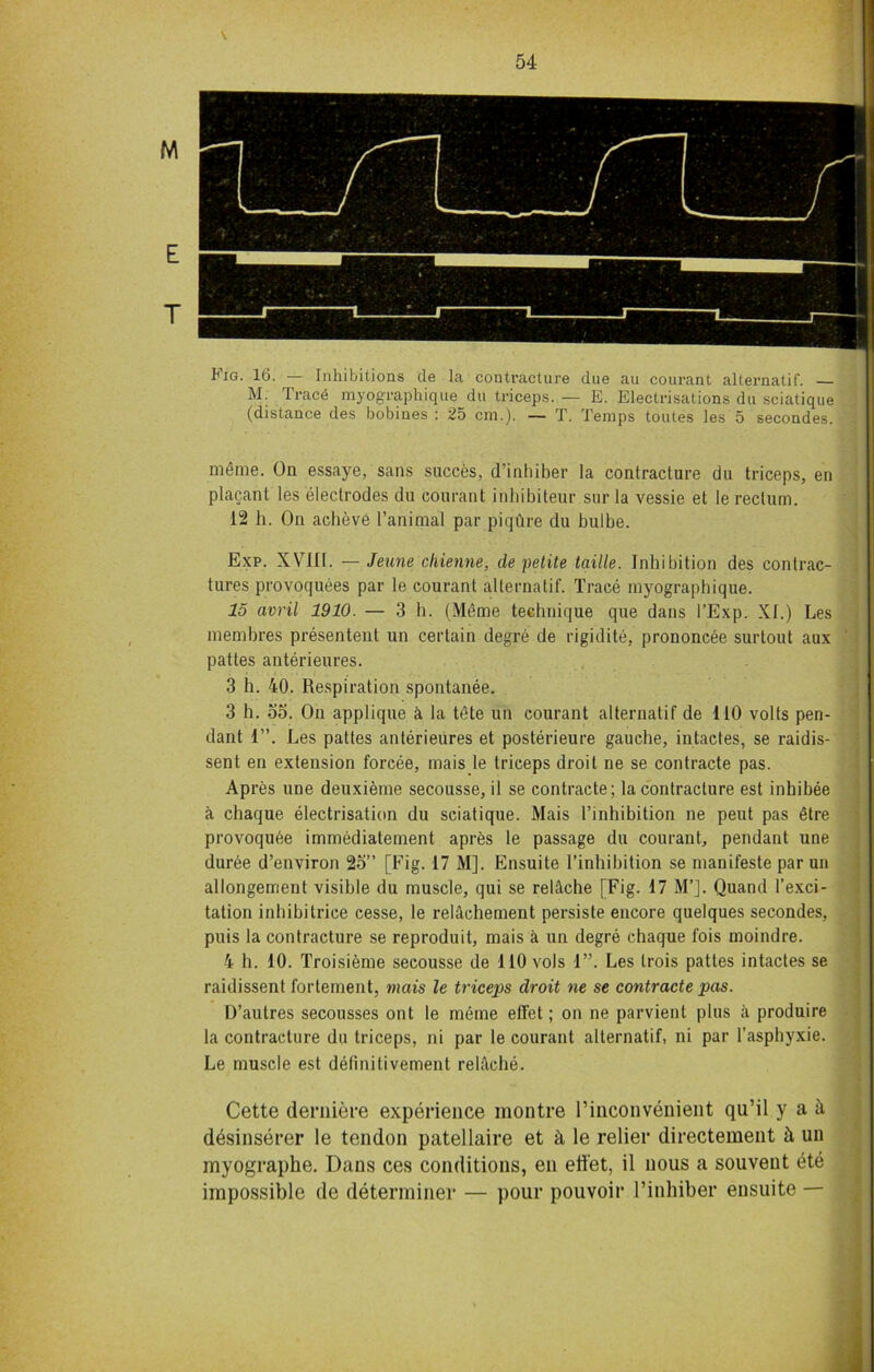 I^ig. 16. — Inhibitions de la contracture due au courant alternatif. M. trace myographique du triceps.— E. Electrisations du sciatique (distance des bobines : 25 cm.). — T. Temps toutes les 5 secondes. meme. On essaye, sans succes, d’inhiber la contracture du triceps, en placant les electrodes du courant inhibiteur sur la vessie et le rectum. 12 h. On aclieve l’animal par piqfire du bulbe. Exp. XVIII. — Jeune chienne, de petite taille. Inhibition des contrac- tures provoquees par le courant alternatif. Trace myographique. 15 avril 1910. — 3 h. (Mdme technique que dans l’Exp. XI.) Les membres presentent un certain degre de rigidite, prononcee surtout aux pattes anterieures. 3 h. 40. Respiration spontanee. 3 h. oo. On applique it la tete un courant alternatif de 110 volts pen- dant 1”. Les pattes anterieures et posterieure gauche, intactes, se raidis- sent en extension forcee, mais le triceps droit ne se contracte pas. Apres line deuxieine secousse, il se contracte; la contracture est inhibee a chaque electrisation du sciatique. Mais l’inhibition ne peut pas dtre provoqude immediatement apres le passage du courant, pendant une duree d’environ 25” [Fig. 17 M]. Ensuite I’inhibition se manifeste par un allongement visible du muscle, qui se rel&che [Fig. 17 M’J. Quand l’exci- tation inhibitrice cesse, le relachement persiste encore quelques secondes, puis la contracture se reproduit, mais a un degre chaque fois moindre. 4 h. 10. Troisieme secousse de 110 vols 1”. Les trois pattes intactes se raidissent fortement, mais le triceps droit ne se contracte pas. D’autres secousses ont le meme elfet; on ne parvient plus a produire la contracture du triceps, ni par le courant alternatif, ni par l’asphyxie. Le muscle est definitivement rehlche. Cette deniiere experience montre rinconvenient qu’il y a ii desinserer le tendon patellaire et A le relier directement ft un inyographe. Dans ces conditions, en ett’et, il nous a souvent ete impossible de determiner — pour pouvoir l’inhiber ensuite —