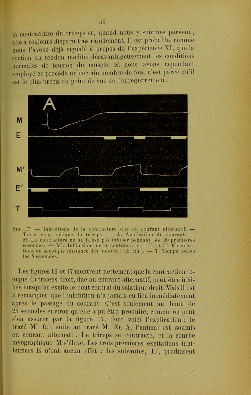 la contracture du triceps et, quand nous y sorames parvenu, elle a toujours disparu trbs rapidement. 11 est probable, comme nous l’avons dejfi signale h propos de l’experience XI, que la section du tendon moditie desavantageusement les conditions normales de tension du muscle. Si nous avons cependant employe ce procede un certain nombre de fois, c’est parce qu’il est le plus precis au point de vue de renregistrement. ( M E M' E' T Fig. 17. — Inhibitions de la contracture due au coufant alternatif. — Trace myographique du triceps. — A. Application du courant. — M. La contracture ne se laisse pas inhiber pendant les 20 premieres secondes. — M’. Inhibitions de la contracture. — E. et E’. Electrisa- tions du sciatique (distance des bobines : 25 cm.). — T. Temps toutes les 5 secondes. Les figures 16 et 17 montrent nettement que la contraction to- nique du triceps droit, due au courant alternatif, peut etre inhi- bee lorsqu’on excite le bout central du sciatique droit. Mais il est a remarquer que l’inhibition n’a jamais eu lieu immediatement apres le passage du courant. C’est seulement au bout de 25 secondes environ qu’elle a pu etre produite, comme on peut s’en assurer par la figure 17, dont voici l’explication : le trace M’ fait suite au trace M. En A, l’animal est sounds au courant alternatif. Le triceps se contracte, et la courbe myographique M s’eleve. Les trois premieres excitations inhi- bitrices E n’ont aucun effet ; les suivantes, E’, produisent