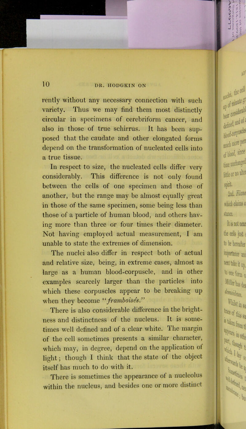rently without any necessary connection with such variety. Thus we may find them most distinctly circular in specimens of cerebriform cancer, and also in those of true schirrus. It has been sup- posed that the caudate and other elongated forms depend on the transformation of nucleated cells into a true tissue. In respect to size, the nucleated cells differ very considerably. This difference is not only found between the cells of one specimen and those of another, but the range may be almost equally great in those of the same specimen, some being less than those of a particle of human blood, and others hav- ing more than three or four times their diameter. Not having employed actual measurement, I am unable to state the extremes of dimension. The nuclei also differ in respect both of actual and relative size, being, in extreme cases, almost as large as a human blood-corpuscle, and in other examples scarcely larger than the particles into which these corpuscles appear to be breaking up when they become “framboise's.’’ There is also considerable difference in the bright- ness and distinctness of the nucleus. It is some- times well defined and of a clear white. The margin of the cell sometimes presents a similar character, which may, in degree, depend on the application ol light; though I think that the state of the object itself has much to do with it. There is sometimes the appearance of a nucleolus within the nucleus, and besides one or more distinct
