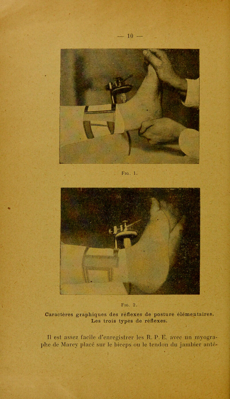 Fig. 2. Caractères graphiques des réflexes de posture élémentaires. Les trois types de réflexes. . ' * I Il est assez facile d’enregistrer les R. P. E. avec un myogra- phe de Marey placé sur le biceps ou le tendon du jainbier anté-