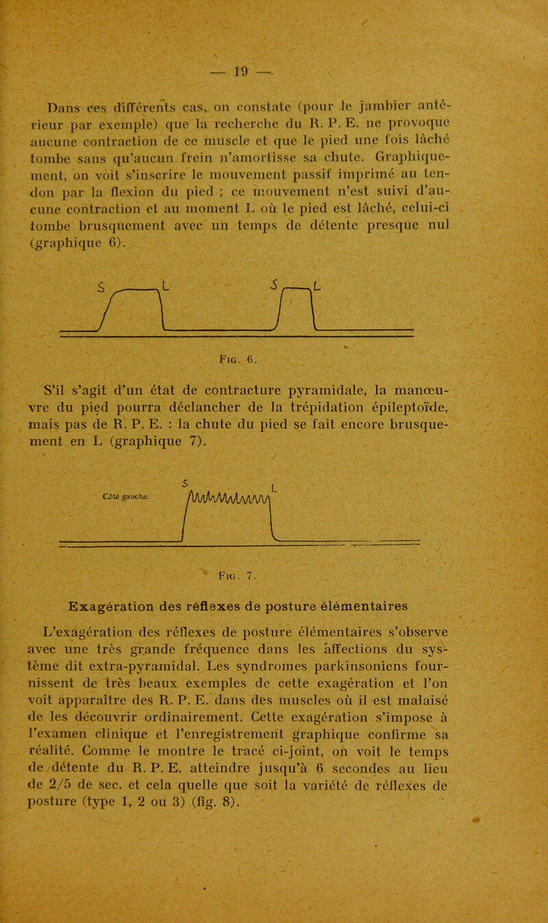 — 19 — Dans ees différents cas, on constate (pour le jambier anté- rieur par exemple) que la recherche du R. P. E. ne provoque aucune contraction de ce muscle et que le pied une lois lâché tombe sans qu’aucun frein n’amortisse sa chute. Graphique- ment, on voit s’inscrire le mouvement passif imprimé au ten- don par la flexion du pied ; ce mouvement n’est suivi d’au- cune contraction et au moment L où le pied est lâché, celui-ci tombe brusquement avec un temps de détente presque nul (graphique 6). S’il s’agit d’un état de contracture pyramidale, la manœu- vre du pied pourra déclancher de la trépidation épileptoïde, mais pas de R. P. E. : la chute du pied se fait encore brusque- ment en L (graphique 7). Fig. 7. Exagération des réflexes de posture élémentaires L’exagération des réflexes de posture élémentaires s’observe avec une très grande fréquence dans les affections du sys- tème dit extra-pyramidal. Les syndromes parkinsoniens four- nissent de très beaux exemples de cette exagération et l’on voit apparaître des R. P. E. dans des muscles où il est malaisé de les découvrir ordinairement. Cette exagération s’impose à l’examen clinique et l’enregistrement graphique confirme sa réalité. Comme le montre le tracé ci-joint, on voit le temps de détente du R. P. E. atteindre jusqu’à 6 secondes au lieu de 2/5 de sec. et cela quelle que soit la variété de réflexes de posture (type 1, 2 ou 3) (fig. 8).