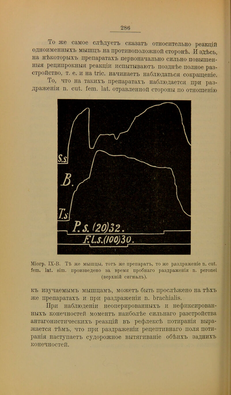 To me caMoe cji'fcjiyeT'B cKasaTi) OTHOCHxejibno peaKi],ift OjXHOHMeilllHX’L MHnmx, Ha npoTHBonojiOHmofl CTopoHt. H sa-fecb, Ha H'iiKOTopHX'b ripenapaTaxi> nepBoiianajibHo CHJibiio noBHmeH- HHH pepHHpOKHHH peaKpill HCHHTHBaiOT'b HOBJIH'i.e HOJIHOe pa3- CTpoflcTBO, T. e. H Ha trie. HaHiiHaeTa) Hadjiioj^aTbCH C0KpaH],eHie, To, HTO Ha TaKHxa) npenaparax'b Ha6jiiOAa.eTCH npn pas- ;i;pajKeHiH n. cut. fern. lat. orpaBJiGHHOfl cxopoHbi no oxHoniemio Miorp. IX-B. Ti Mce Mumabi, Tora ace npenapaTt, to ace pasApaacenie n. cut. fem. lat. sim. npoHSBeaeHO aa Bpeiia npo6Haro paaapaaceHia n. peronei (BepxHifi cnrHaJiT>). KTb H3yHaeMHMX> MHnmaMXj, MomexH 6hxb npoGJiibiiteHO na x'fex'b Hte npenaparax'b h npn pasApantemH n. brachialis. Ilpn HaSjHoneHin HeonepnpoBaHHbix'b n He(|)HKCHpoBaH- hhxxj KOHeuHocxefl MOMeHr-b HanSojibe cHJibnaro paacxpoflcxBa aHxaroHHcxHHecKHX'b peaitpifi b'b pe(|3JieKC'fe noxiipaHin BHpa- 5KaexcH x'i.M'b, nxo npn paBzipanteiiiii pepenxiiBHaro hojih hoxii- panifl Hacxynaex'b cynopoHCHoe BHrarriBanie 06'bir.x'b aajiHiixb KOHeHHOCXetl.
