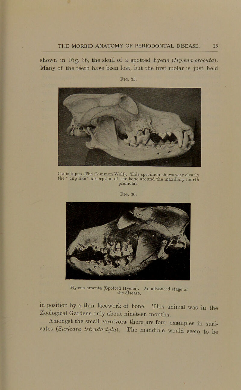 shown in Fig. 36, the skull of a spotted hyena (Hycena crocuta). Many of the teeth have been lost, but the first molar is just held Pig. 35. Canis lupus (The Common Wolf). This specimen shows very clearly the “ cup-like ” absorption of the bone around the maxillary fourth premolar. Fig. 36. Hyaena crocuta (Spotted Hyena). An advanced stage of the disease. in position by a thin lacework of bone. This animal was in the Zoological Gardens only about nineteen months. Amongst the small carnivora there are four examples in suri- cates (Suricata tetradactyla). The mandible would seem to be