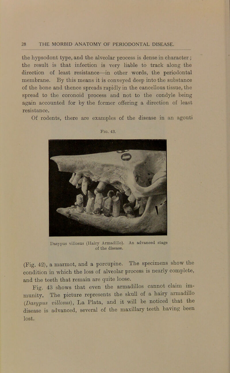 the hypsodont type, and the alveolar process is dense in character ; the result is that infection is very liable to track along the direction of least resistance—in other words, the periodontal membrane. By this means it is conveyed deep into the substance of the bone and thence spreads rapidly in the cancellous tissue, the spread to the coronoid process and not to the condyle being again accounted for by the former offering a direction of least resistance. Of rodents, there are examples of the disease in an agouti Fig. 43. Dasypus villosus (Hairy Armadillo). An advanced stage of the disease. (Fig. 42), a marmot, and a porcupine. The specimens show the condition in which the loss of alveolar process is nearly complete, and the teeth that remain are quite loose. Fig. 43 shows that even the armadillos cannot claim im- munity. The picture represents the skull of a hairy armadillo (.Dasypus villosus), La Plata, and it will be noticed that the disease is advanced, several of the maxillary teeth having been lost.