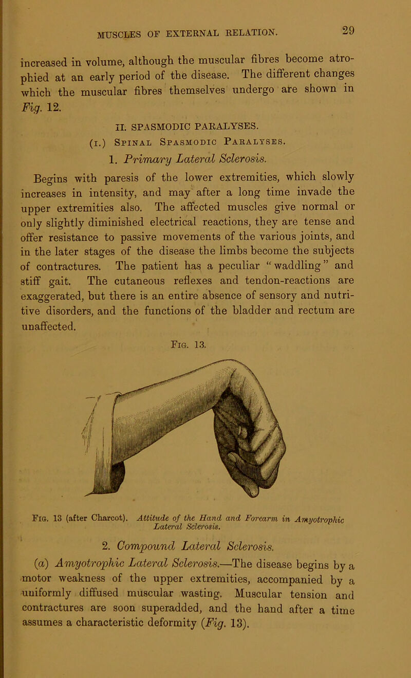 increased in volume, although, the muscular fibres become atro- phied at an early period of the disease. The different changes which the muscular fibres themselves undergo are shown in Fig. 12. II. SPASMODIC PARALYSES. (i.) Spinal Spasmodic Paralyses. 1. Primary Lateral Sclerosis. Begins with paresis of the lower extremities, which slowly increases in intensity, and may after a long time invade the upper extremities also. The affected muscles give normal or only slightly diminished electrical reactions, they are tense and offer resistance to passive movements of the various joints, and in the later stages of the disease the limbs become the subjects of contractures. The patient has a peculiar “waddling” and stiff gait. The cutaneous reflexes and tendon-reactions are exaggerated, but there is an entire absence of sensory and nutri- tive disorders, and the functions of the bladder and rectum are unaffected. Fig. 13. Fig. 13 (after Charcot). Attitude of the Hand and Forearm in Amyotrophic Lateral Sclerosis. 2. Compound Lateral Sclerosis. (a) Amyotrophic Lateral Sclerosis.—The disease begins by a motor weakness of the upper extremities, accompanied by a uniformly diffused muscular wasting. Muscular tension and contractures are soon superadded, and the hand after a time assumes a characteristic deformity (Fig. 13).