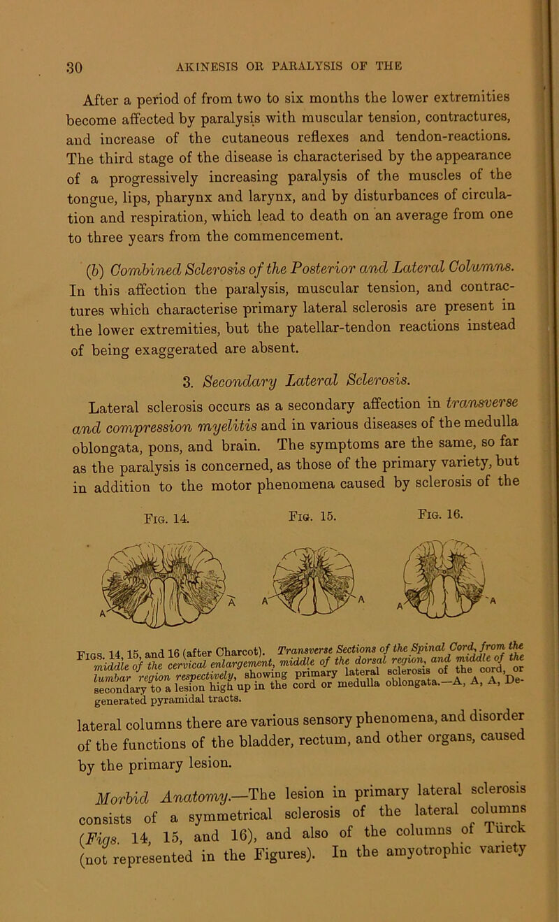 After a period of from two to six months the lower extremities become affected by paralysis with muscular tension, contractures, and increase of the cutaneous reflexes and tendon-reactions. The third stage of the disease is characterised by the appearance of a progressively increasing paralysis of the muscles of the tongue, lips, pharynx and larynx, and by disturbances of circula- tion and respiration, which lead to death on an average from one to three years from the commencement. (b) Combined Sclerosis of the Posterior and Lateral Columns. In this affection the paralysis, muscular tension, and contrac- tures which characterise primary lateral sclerosis are present in the lower extremities, but the patellar-tendon reactions instead of being exaggerated are absent. 3. Secondary Lateral Sclerosis. Lateral sclerosis occurs as a secondary affection in transverse and compression myelitis and in various diseases of the medulla oblongata, pons, and brain. The symptoms are the same, so far as the paralysis is concerned, as those of the primary variety, but in addition to the motor phenomena caused by sclerosis of the Fig. 14. Fig. 15. Fig. 16. generated pyramidal tracts. lateral columns there are various sensory phenomena, and disorder of the functions of the bladder, rectum, and other organs, caused by the primary lesion. Morbid Anatomy.-The lesion in primary lateral sclerosis consists of a symmetrical sclerosis of the lateral columns (Fins 14, 15, and 16), and also of the columns of Turck (not represented in the Figures). In the amyotrophic variety