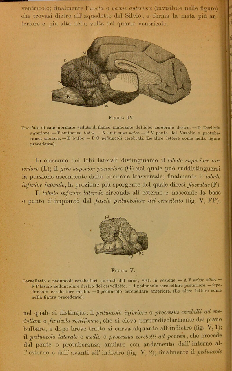 ventricolo; finalmente Vuvola o venne anteriore (invisibile nelle figure) che trovasi dietro all’ aqnedotto del Silvio, e forma la metà più an- teriore e pili alta della volta del quarto ventricolo. Figuba IV. Encefalo di cane normale veduto dì fianco mancante del lobo cerebrale destro. — D' Declivio anteriore.—T eminenze teates. — N eminenze natta. — P V ponto del Varolio o protube- ranza anulare. — B bulbo — PC peduncoli cerebrali. (Lo altre lettere come nella figura precedente). In ciascuno dei lobi laterali distinguiamo il lobulo superiore an- teriore (L) ; il giro sìtperior posteriore (G) nel quale può suddistinguersi la porzione ascendente dalla porzione trasversale; finalmente il lobulo inferior laterale ^Isi porzione più sporgente del quale dicesi (F). Il lobulo inferior laterale circonda all’ esterno e nasconde la base o punto d’impiantò del fascio peduncolare del cervelletto (fig. V, FP), Figura V. Cei’vellotto o peduncoli cerebellari normali del cane, visti in sezione. — A V arbor vitae. F P fascio peduncolare destro del cervelletto. — 1 peduncolo cerebellare posteriore. — 2 pe- duncolo cerebellare medio. — 3 peduncolo cerebellare anteriore. (Lo altre lettere come nella figura precedente). nel quale si distingue : il peduncolo inferiore o processus cerebelli ad me- didlam o funicolo restiformej che si eleva jDerpendicolarinente dal piano bulbare, e dopo breve tratto si curva alquanto all’indietro (fig. V, 1); il peduncolo laterale o medio o processus cerebelli ad pontem, che procede dal ponte o protuberanza anulare con andamento dall’ interno al- 1’esterno e dall’avanti all’indietro (fig. V, 2); finalmente ì\ peduncolo