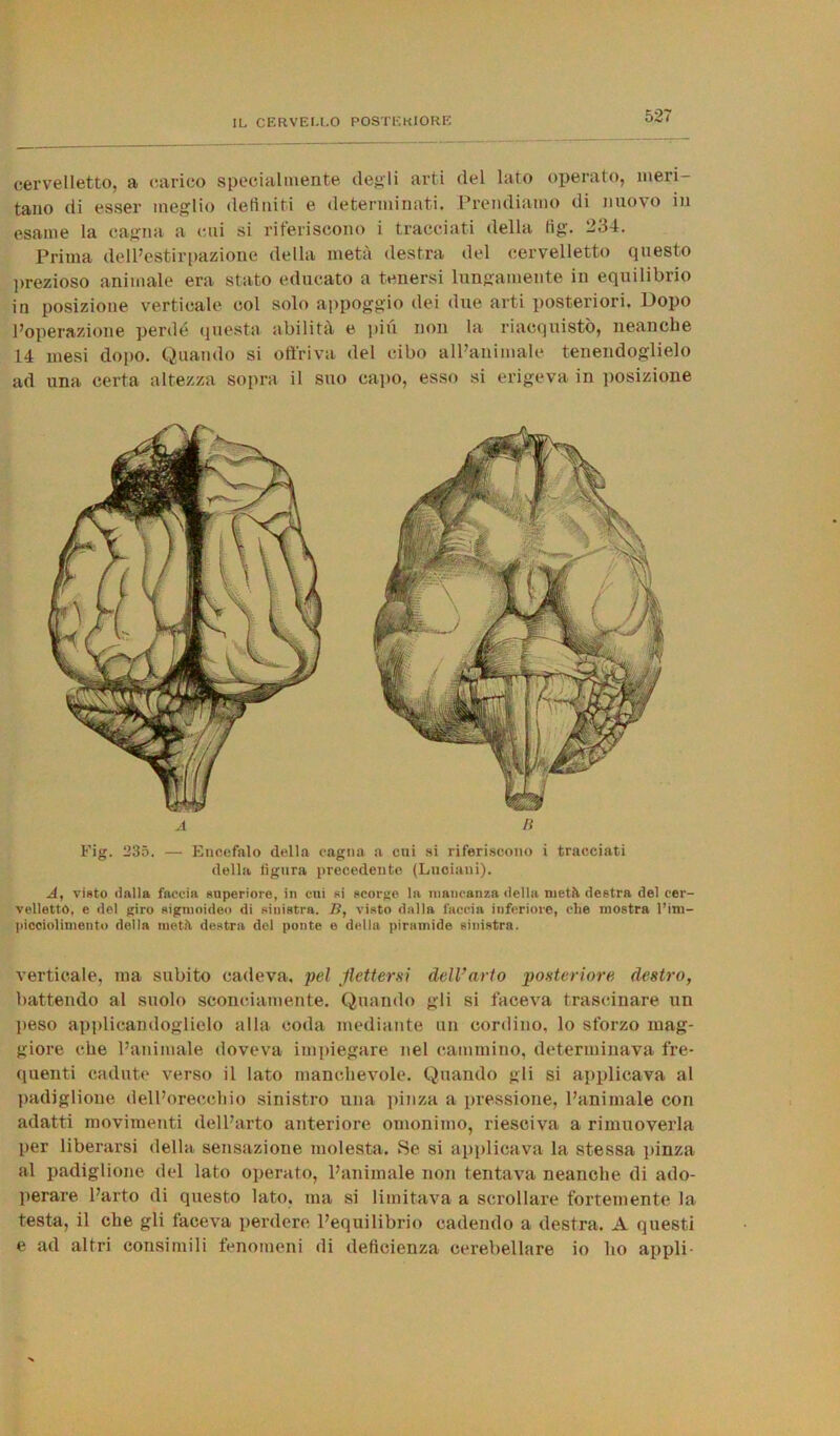 cervelletto, a carico specialmente degli arti del lato operato, meri- tano di esser meglio definiti e determinati. Prendiamo di nuovo in esame la cagna a cui si riferiscono i tracciati della tìg. 234. Prima dell’estirpazione della metà destra del cervelletto questo prezioso animale era stato educato a tenersi lungamente in equilibrio in posizione verticale col solo appoggio dei due arti posteriori. Dopo l’operazione perde questa, abilità e piu non la riacquistò, neanche 14 mesi dopo. Quando si offriva del cibo all’animale tenendoglielo ad una certa altezza sopra il suo capo, esso si erigeva in posizione Fig. 235. — Encefalo della cagna a cui si riferiscono i tracciati della figura precedente (Luciani). A, visto dalla faccia superiore, in cui si scorge la mancanza della metìt destra del cer- velletto, e del giro sigmoideo di sinistra. B, visto dalla faccia inferiore, che mostra l’im- picciolimento della metti destra del ponte e della piramide sinistra. verticale, ma subito cadeva, pel flettersi dell’arto posteriore, destro, battendo al suolo sconciamente. Quando gli si faceva trascinare un peso applicandoglielo alla coda mediante un cordino, lo sforzo mag- giore che l’animale doveva impiegare nel cammino, determinava fre- quenti cadute verso il lato manchevole. Quando gli si applicava al padiglione dell’orecchio sinistro una pinza a pressione, l’animale con adatti movimenti dell’arto anteriore omonimo, riesciva a rimuoverla per liberarsi della sensazione molesta. Se si applicava la stessa pinza al padiglione del lato operato, l’animale non tentava neanche di ado- perare L’arto di questo lato, ma si limitava a scrollare fortemente la testa, il che gli faceva perdere l’equilibrio cadendo a destra. A questi e ad altri consimili fenomeni di deficienza cerebellare io ho appli