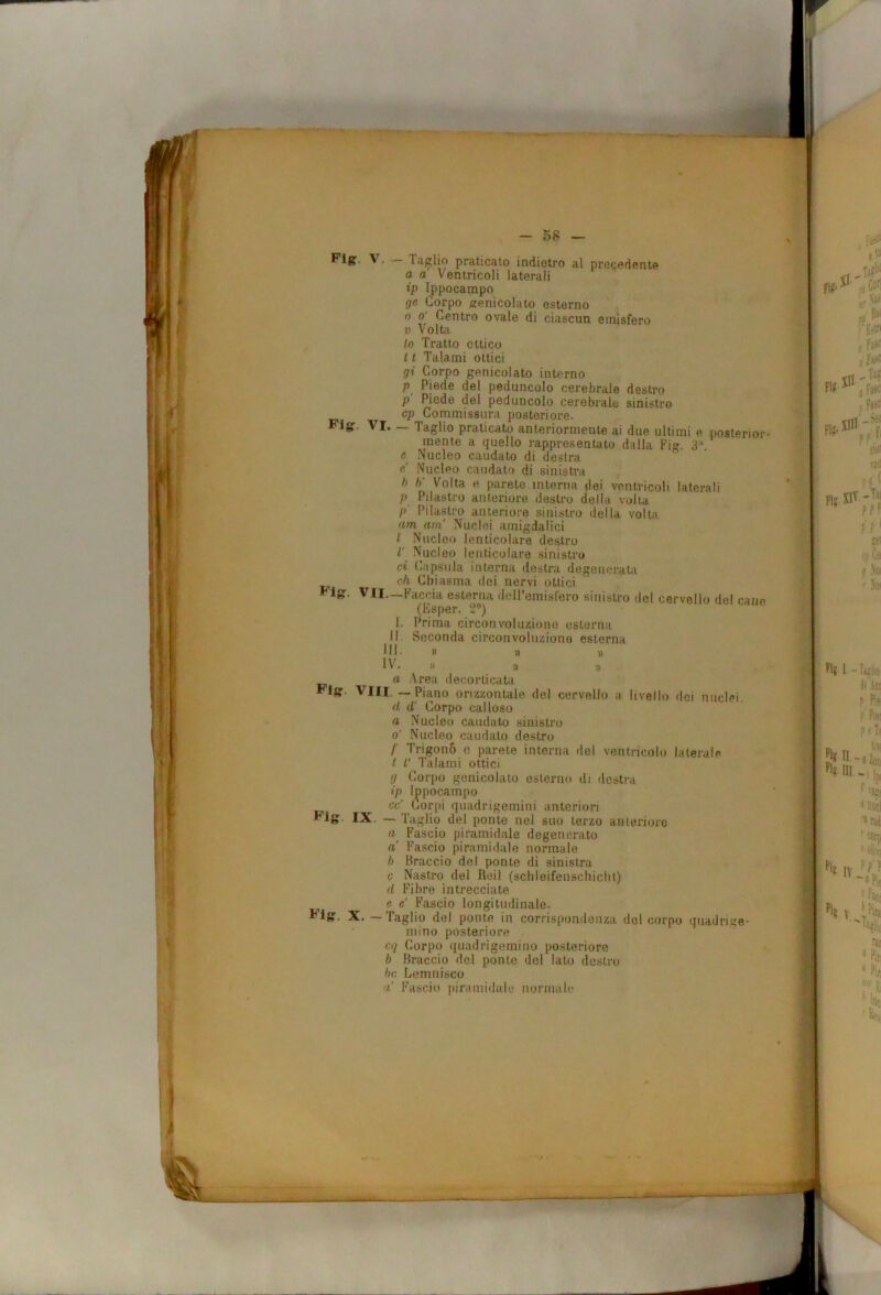 V. — Taglio praticato indietro al precedente a a Ventricoli laterali ip Ippocampo gfc Corpo genicolato esterno 0 0' Centro ovale di ciascun emisfero V Volta 10 Tratto ottico 11 Talami ottici gì Corpo genicolato intorno Piede del peduncolo cerebrale destro p' Piede del peduncolo cerebrale sinistro cp Commissurn posteriore. Figr. VI. — Taglio praticato anteriormente ai due ultimi e posterior- mente a quello rappresentato dalla Fig. 3^^ « Nucleo caudato di destra c' Nucleo caudato di sinistra h h' Volta e parete interna dei ventricoli laterali p Pilastro anteriore destro della volta p' Pilastro anteriore sinistro della volta am am' Nuclei amigdalici / Nucleo lenticolare destro l' Nucleo lenticolare sinistro ci (àipsula interna destra degenerata r/i Chiasma dei nervi ottici VII—Faccia esterna dell’emisfero sinistro del cervello del cane (Esper. 2®) 1. Prima circonvoluzione esterna 11. Seconda circonvoluzione esterna HI» » » IV. » a a a Area decorticata Vili, — Piano orizzontale del cervello a livello dei nuclei d d' Corpo calloso a Nucleo caudato sinistro o' Nucleo caudato destro /■ Trigono c parete interna del ventricolo laterale ! V Talami ottici !j Corpo genicolato esterno di destra ip Ippocampo cc' Corpi quadrigemini anteriori Flg. IX. — Taglio del ponte nel suo terzo anteriore Fascio piramidale degenerato a Fascio piramidale normale h Braccio del ponte di sinistra 0 Nastro del Reil (schleifenschichl) d Fibre intrecciate e e' Fascio longitudinale. Flg. X. — Taglio del ponte in corrispondenza del corpo quadrige- mino posteriore cq Corpo quadrigemino posteriore b Braccio del ponte del lato destro he Lem ni SCO a Fascio piramidale normale