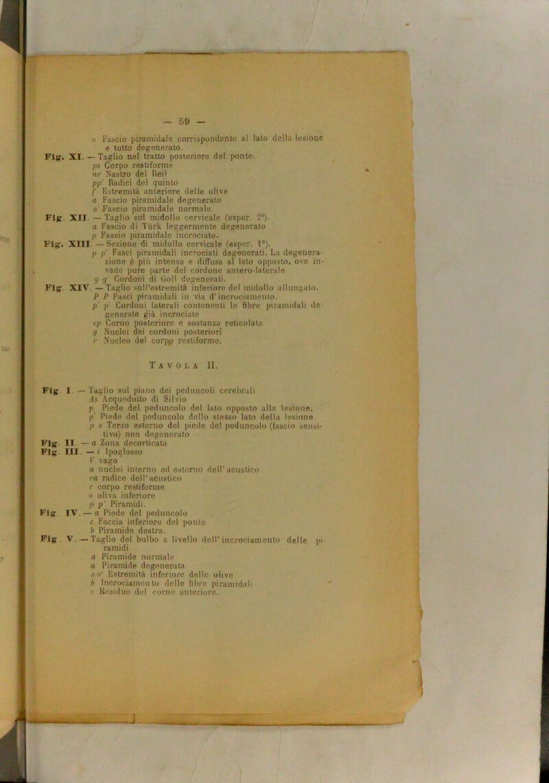 n Fasicio piramidale corrispondenie al lato della lesione e tutto degenerato. Fig. XI. — Taglio nel tratto posteriore del ponte. /is Corpo restiforme nr Nastro del lleil pp’ Radici del quinto f Estremità anteriore delle olive a Fascio piramidale degeneralo a' Fascio piramidale normale. Flg. XII. — Taglio sul midollo cervicale (esper. '2*). a Fascio di Tiirk leggermente degenerato p Fascio piramidale incrociato. Flgr. XIII. — Sezione di midollo cervicale (esper. l®). p p' Fasci piramidali incrociati degenerati. La degenera- zione è più intensa e diffusa al lato opposto, ove in- vade pure parte del cordone antero-laterale g g' Cordoni di Gol! degenerati. Fls XIV. — Taglio sull’estremità inferiore del midollo allungalo. P P Fasci piramidali in via d’incrociamenlo. p' p' Cordoni laterali contenenti le fibre piramidali de- generate già incrocialo cp Corno posteriore e sostanza reticolala g Nuclei dei cordoni posteriori V Nucleo del corpp restiforme. Tavola II. Fig. I. - T aglio sul piano dei peduncoli cerebrali As Acquedotto di Silvio p Piede del peduncolo del lato opposto alla lesione. /)' Piede del peduncolo dello stesso lato della lesione p e Terzo esterno del piede del peduncolo (fascio sensi- tivo) non degenerato FIg II —a Zona decorticata FIg. III. — i Ipoglosso V vago a nuclei interno ed esterno dell’ acustico ra radice dell’acustico r corpo restiforme 0 oliva inferiore p p' Piramidi. Flg IV. —rt Piede del peduncolo 0 Faccia inferiore del ponte h Piramide destra. Flg. V. —Taglio del bulbo a livello dell’incrociamenlo delle pi- ramidi a Piramide normale a Piramide degenerata 0 0' Estremità inferiore delle olive b Incrociameli to delle fibre piramidali c Kesiduo del ''orno unlcrioro.