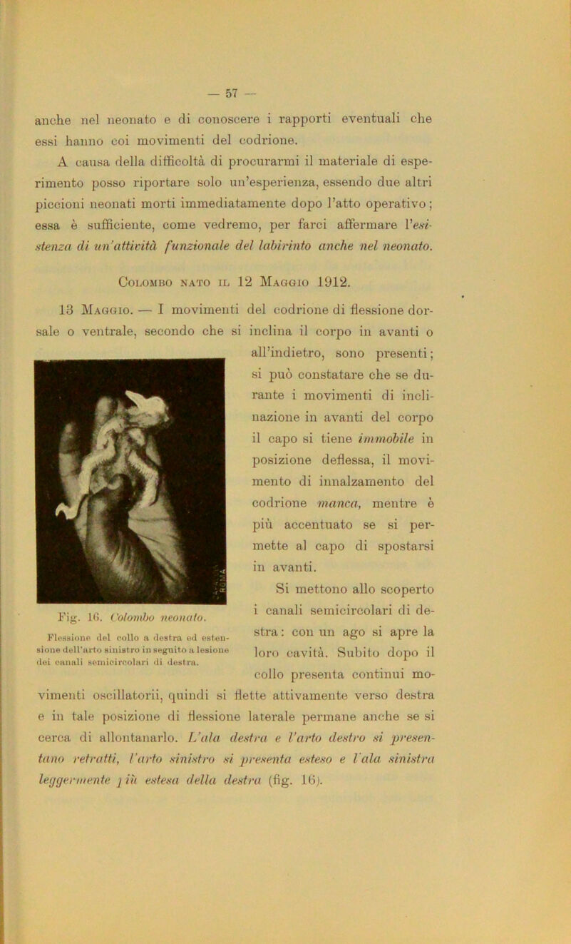 anche nel neonato e di conoscere i rapporti eventuali che essi hanno coi movimenti del codrione. A causa della difficoltà di procurarmi il materiale di espe- rimento posso riportare solo un’esperienza, essendo due altri piccioni neonati morti immediatamente dopo l’atto operativo; essa è sufficiente, come vedremo, per farci affermare l’e.sv- .'itenza di un'attività funzionale dei labirinto anche nel neonato. Colombo nato il 12 Maggio 1912. 13 Maggio. — I movimenti del codrione di flessione dor- sale o ventrale, secondo che si inclina il corpo in avanti o all’indietro, sono presenti ; si può constatare che se du- rante i movimenti di incli- nazione in avanti del corpo il capo si tiene immobile in posizione deflessa, il movi- mento di innalzamento del codrione manca, mentre è più accentuato se si per- mette al capo di spostarsi in avanti. Si mettono allo scoperto i canali semicircolari di de- Fl.ssione del .-olio a destra od osten- «^ra ; COll UH agO si apre la sione duU'urto sinistro ia Heguito a lesione loi'O Cavità SubitO dODO Ì1 dei canali seniiciroolari lii destra. collo presenta continui mo- vimenti oscillatorii, quindi si flette attivamente verso destra e in tale posizione di flessione laterale permane anche se si cerca di allontanarlo. L’ala destra e l’arto destro si presen- tano retratti, l’arto sinistro si presenta esteso e l ala sinistra Icfjgermente ] iù estesa della destra (fig. Ibj.