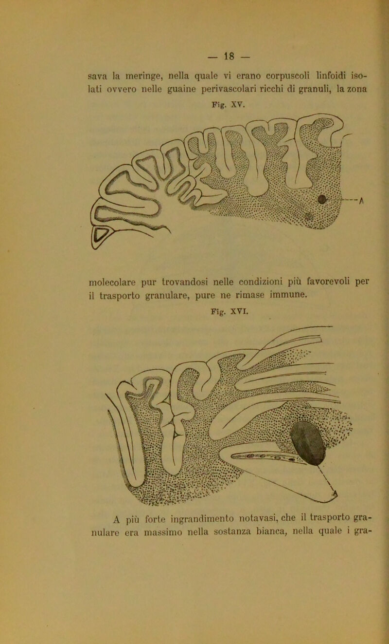 A più forte ingrandimento notavasi, che il trasporto gra- nulare era massimo nella sostanza bianca, nella quale i gra- sava la meringe, nella quale vi erano corpuscoli linfoidi iso- lati ovvero nelle guaine perivascolari ricchi di granuli, la zona Fig. XV. molecolare pur trovandosi nelle condizioni più favorevoli per il trasporto granulare, pure ne rimase immune. Fig. XVI.